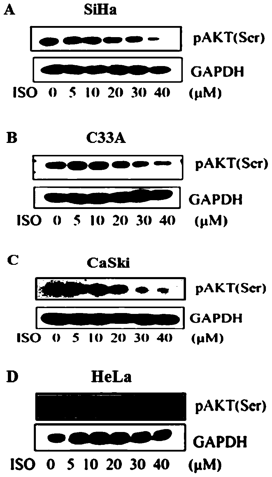 Application of isoliensinine in preparation of drugs for targeted inhibition of AKT activation