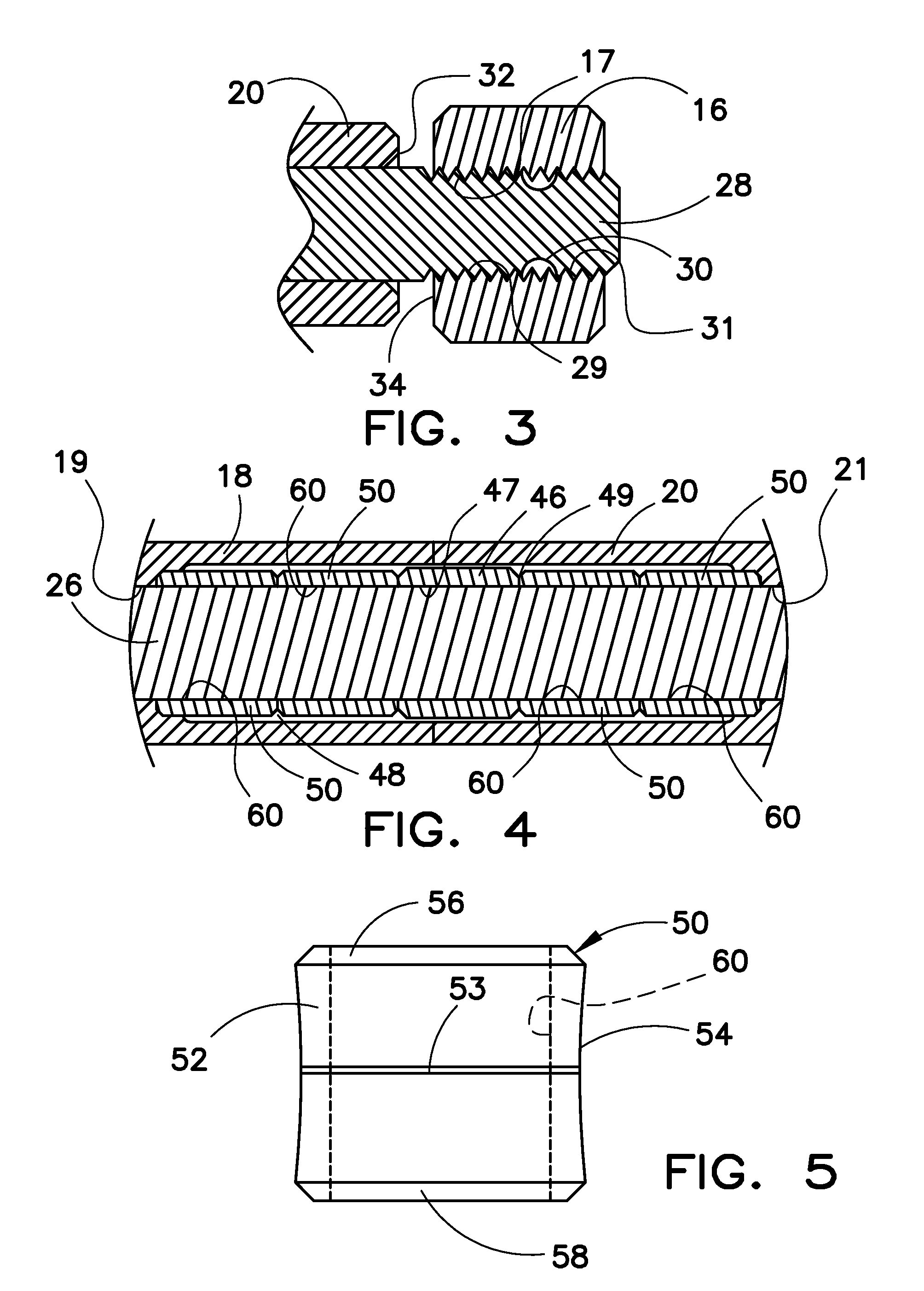 Resilient Spinal Rod System With Controllable Angulation