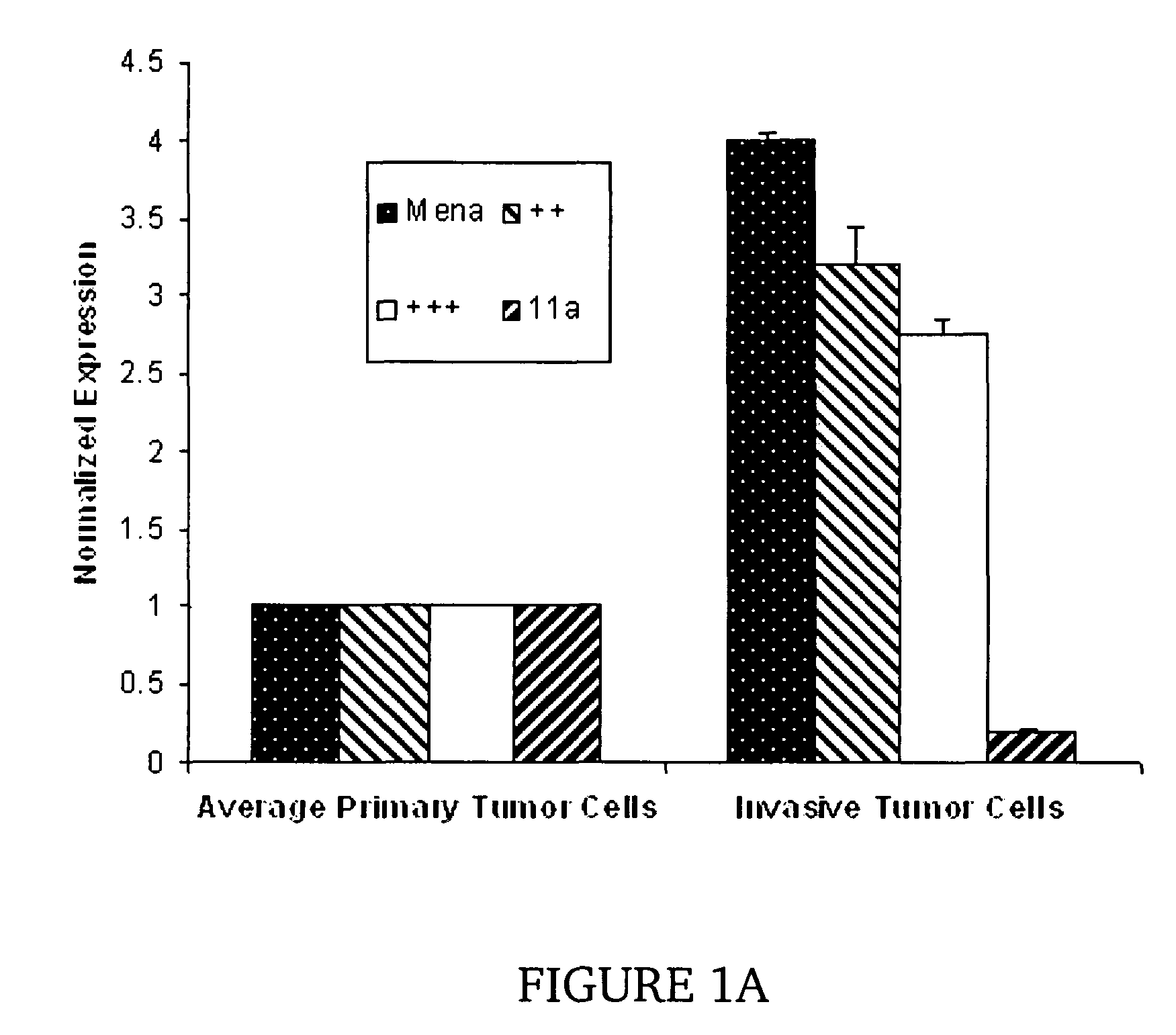 Metastasis specific splice variants of mena and uses thereof in diagnosis, prognosis and treatment of tumors