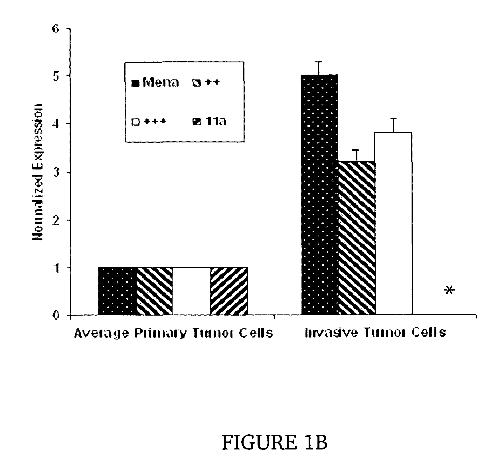 Metastasis specific splice variants of mena and uses thereof in diagnosis, prognosis and treatment of tumors