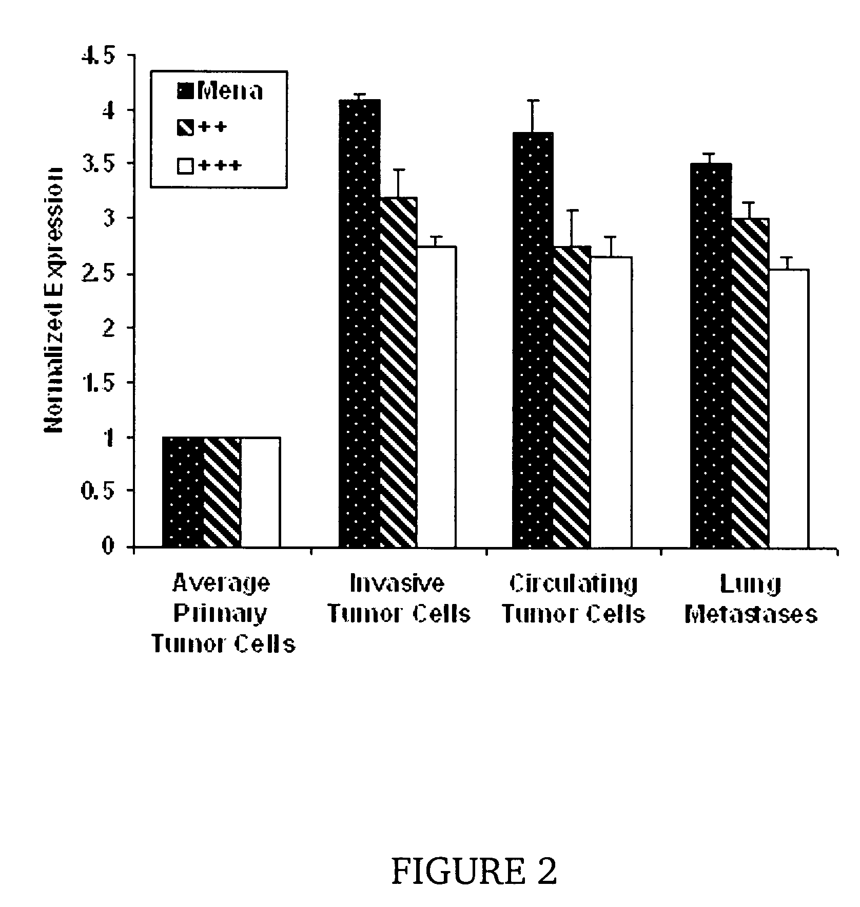 Metastasis specific splice variants of mena and uses thereof in diagnosis, prognosis and treatment of tumors