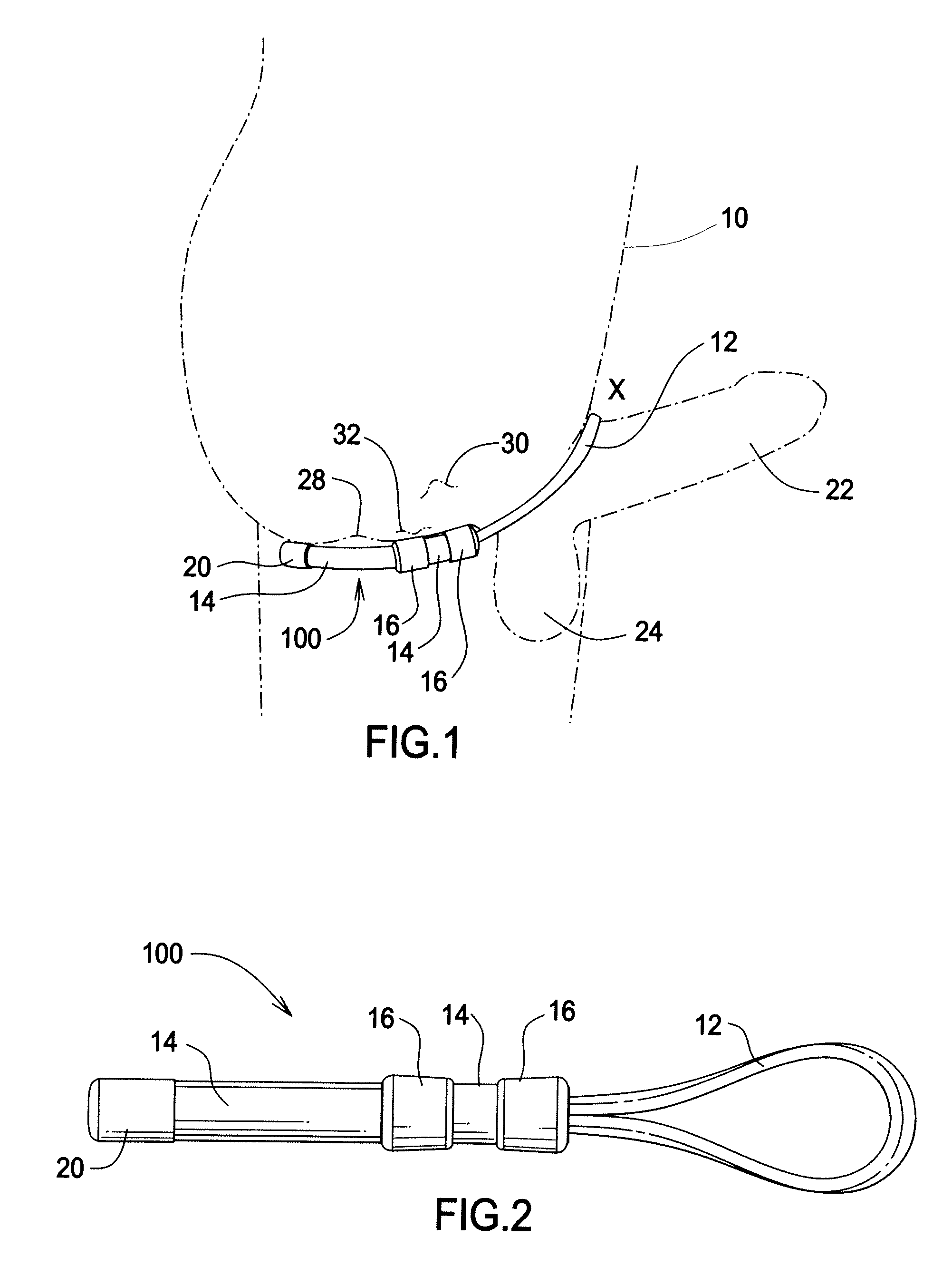 Erection stimulator apparatus and method