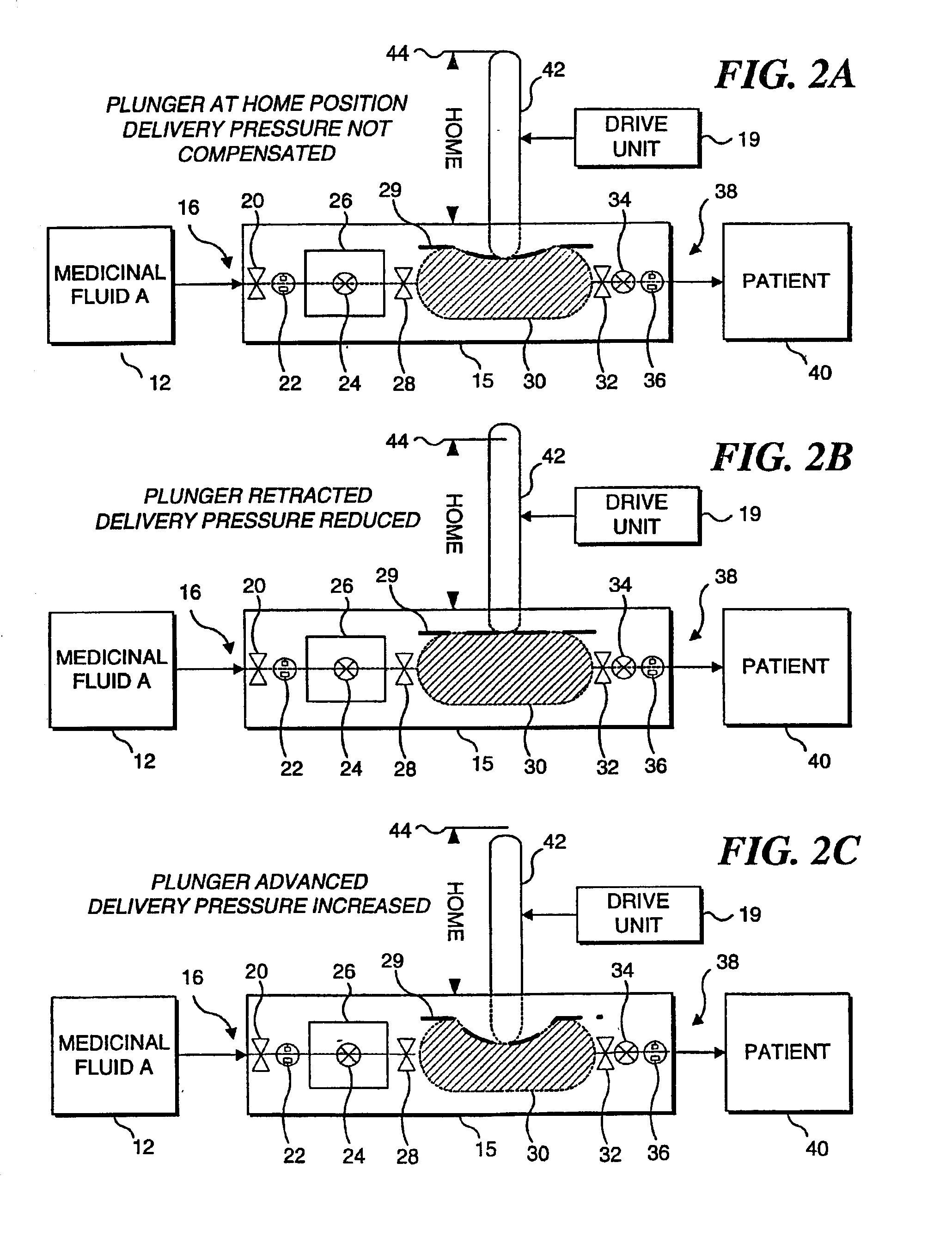 Method for compensating for pressure differences across valves in cassette type IV pump