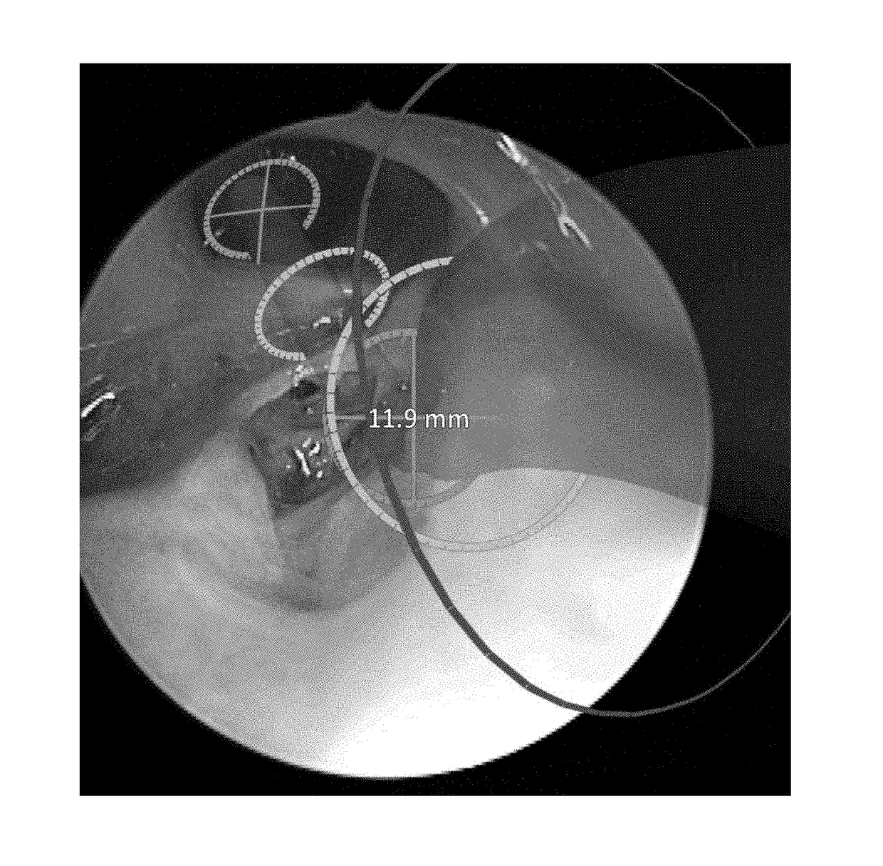 Instrument guidance system for sinus surgery