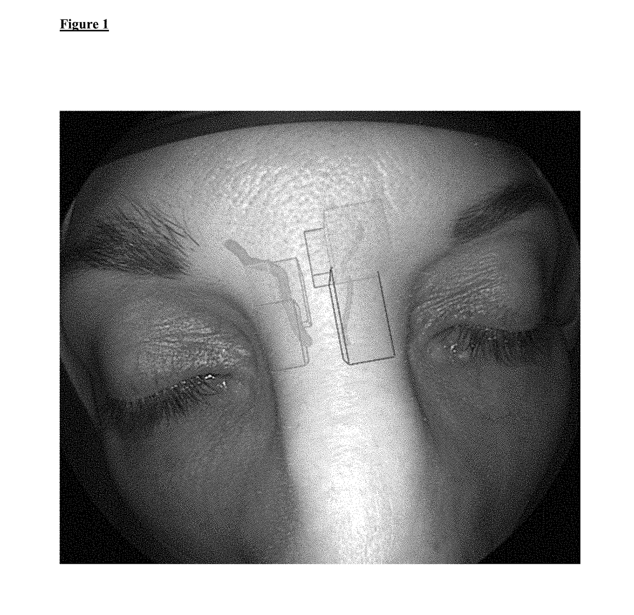 Instrument guidance system for sinus surgery