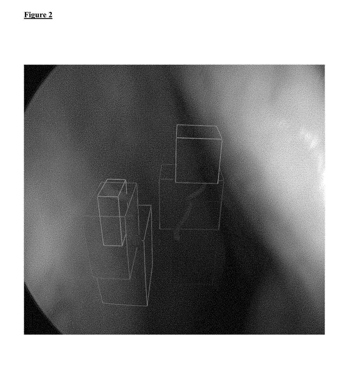 Instrument guidance system for sinus surgery