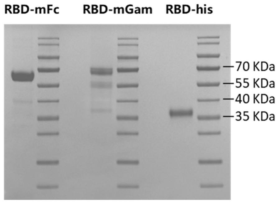 Antibodies against SARS-CoV-2 and uses thereof