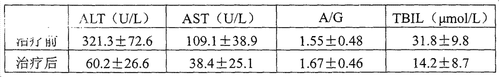 Traditional Chinese medicine composition for treating acute and chronic viral hepatitis and preparation method for traditional Chinese medicine composition