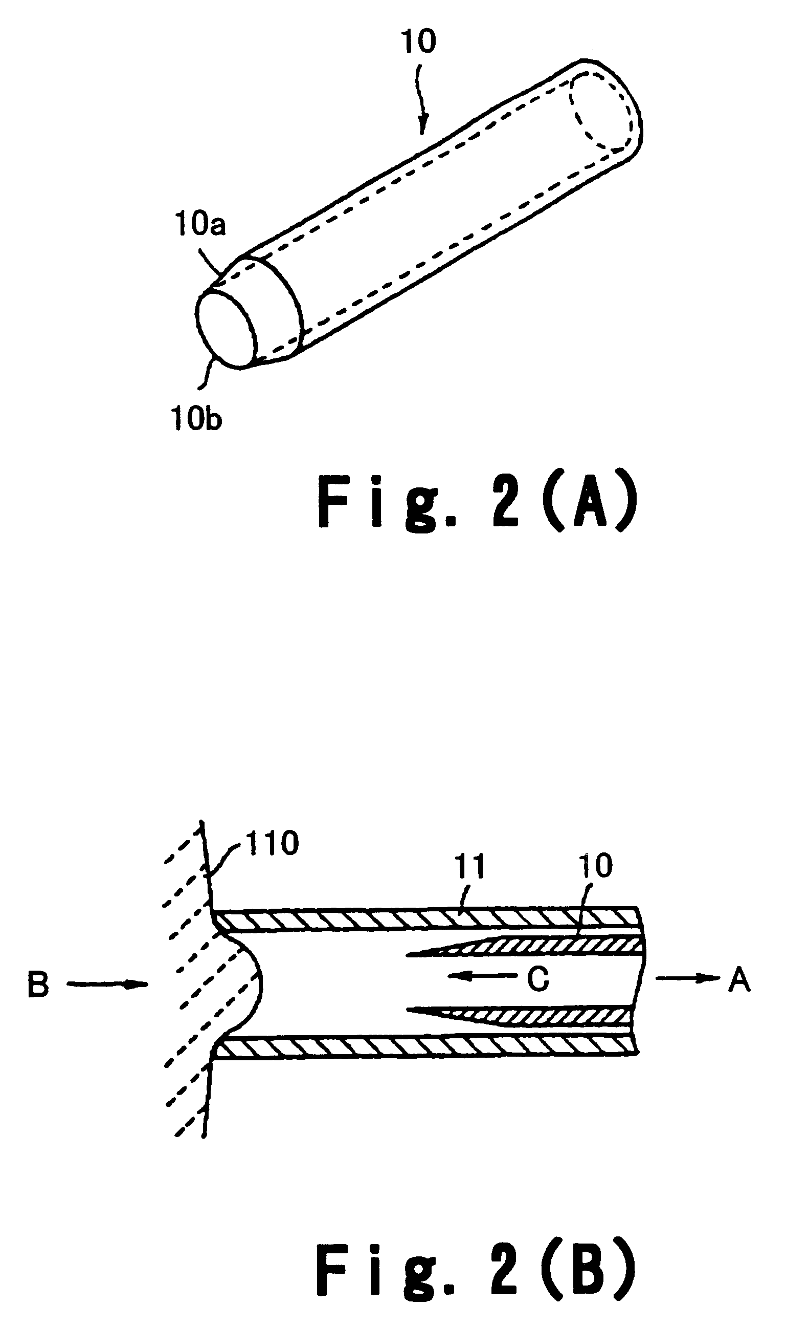 Method of crystalline lens replacement