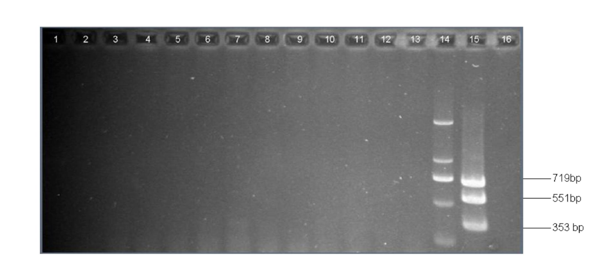 Multiple touchdown PCR (polymerase chain reaction) detection kit of acinetobacter baumannii