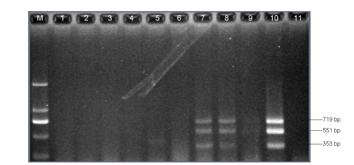 Multiple touchdown PCR (polymerase chain reaction) detection kit of acinetobacter baumannii