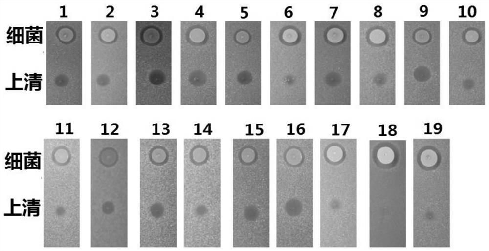 A strain of Staphylococcus epidermidis with broad-spectrum antibacterial activity against Gram-positive drug-resistant bacteria and its screening method and application