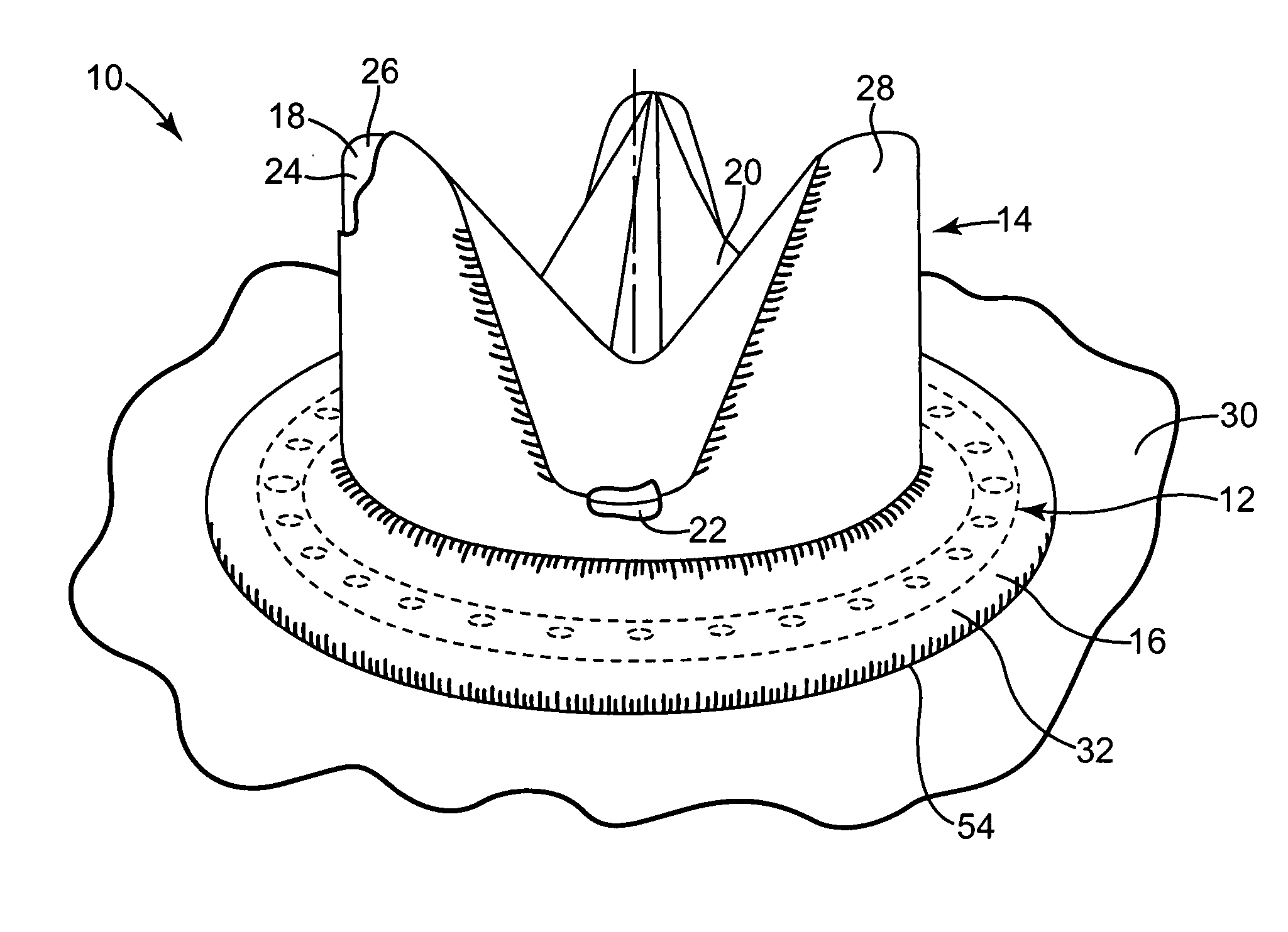 Pharmacological delivery implement for use with cardiac repair devices