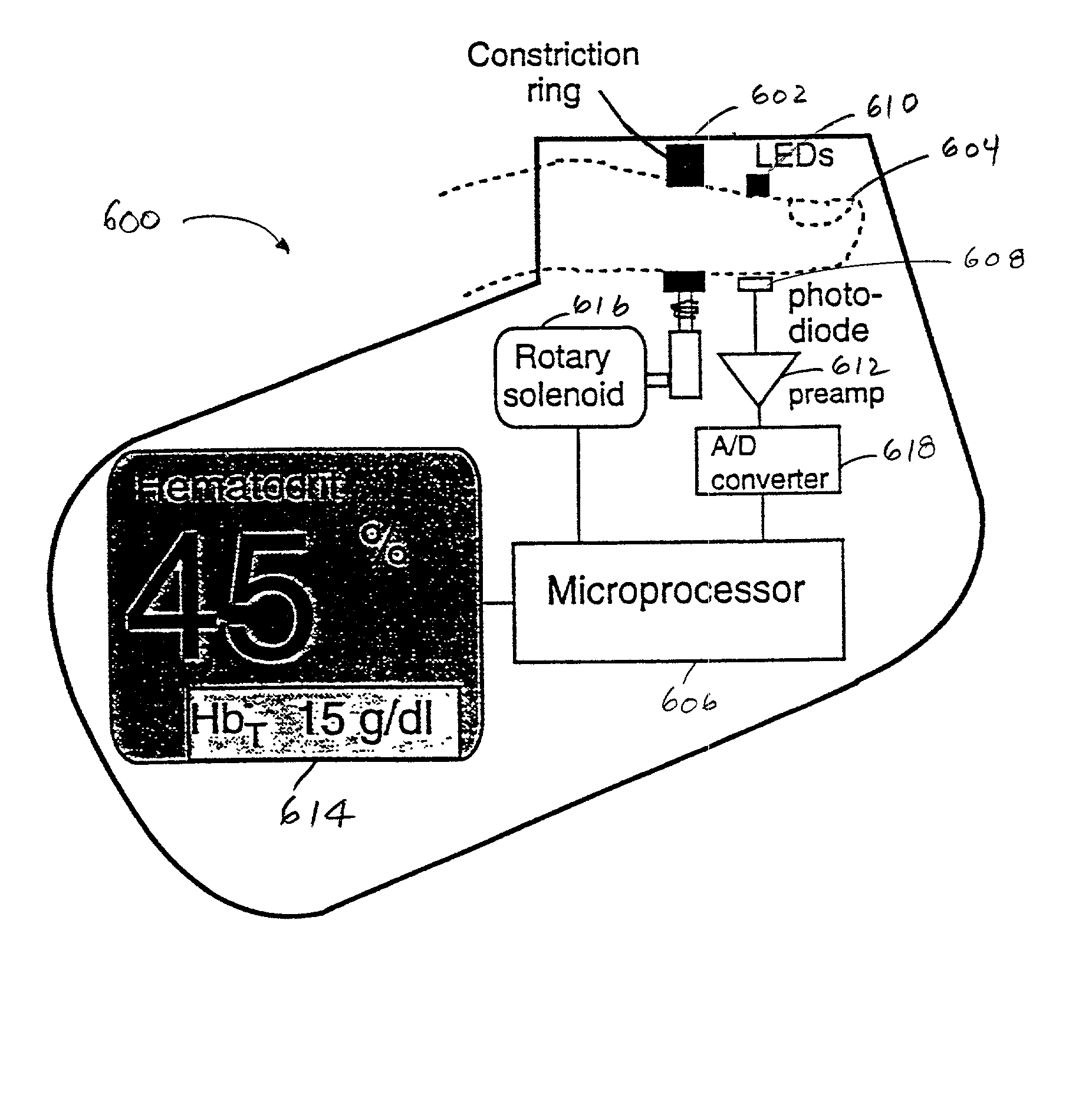 Method and apparatus for improving the accuracy of noninvasive hematocrit measurements