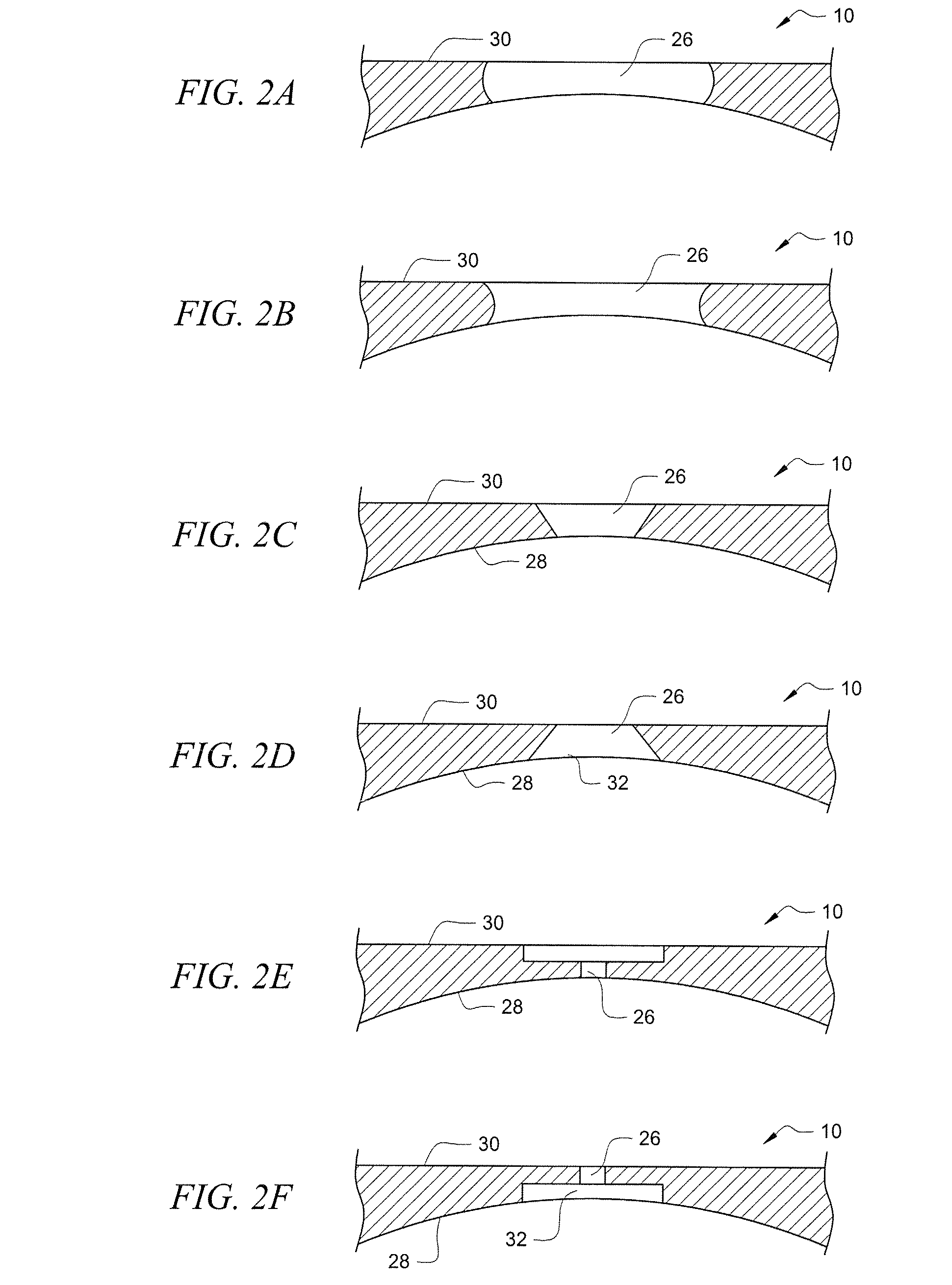 Posterior chamber Phakic Intraocular Lens