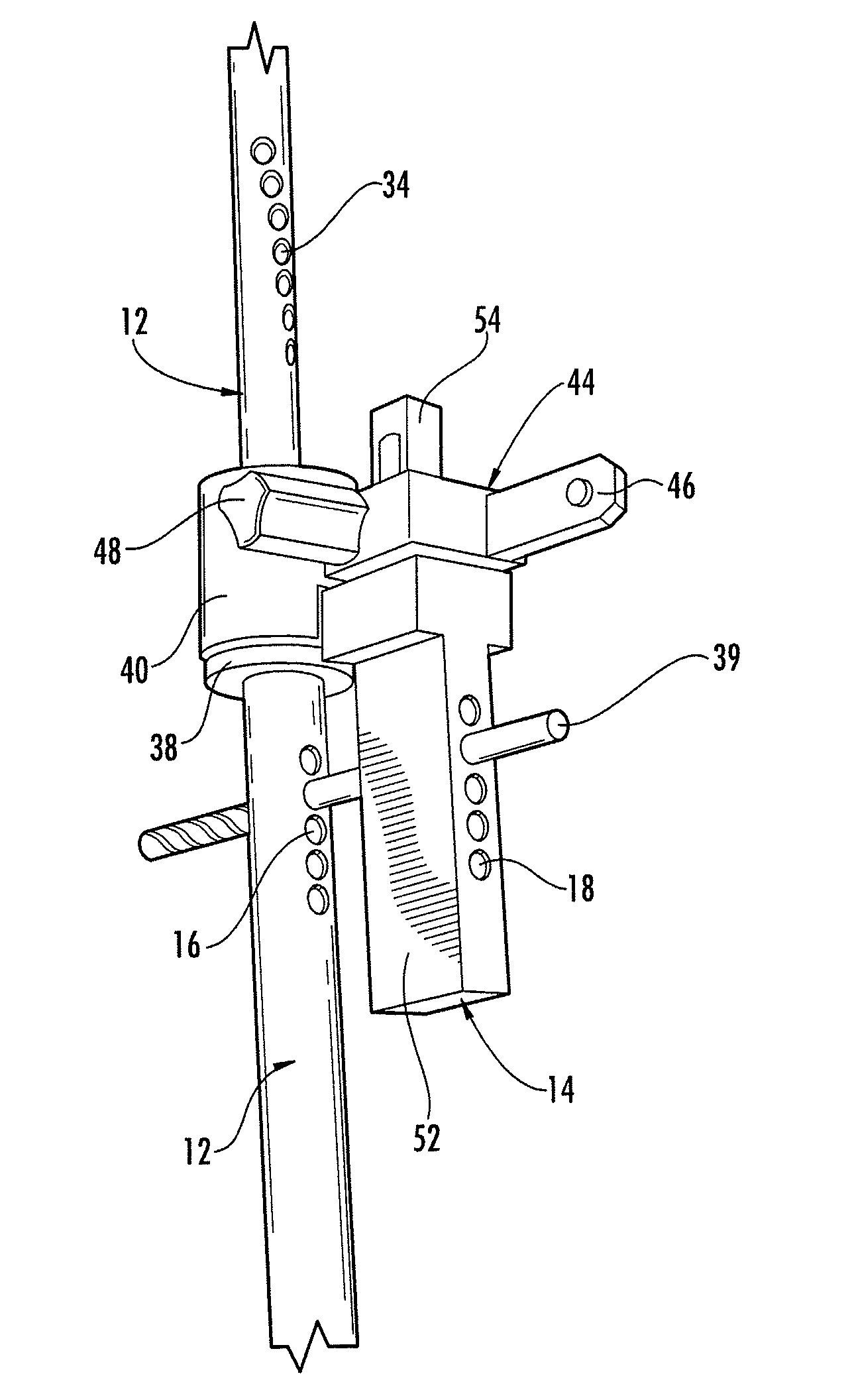 System for treating proximal humeral fractures and method of using the same