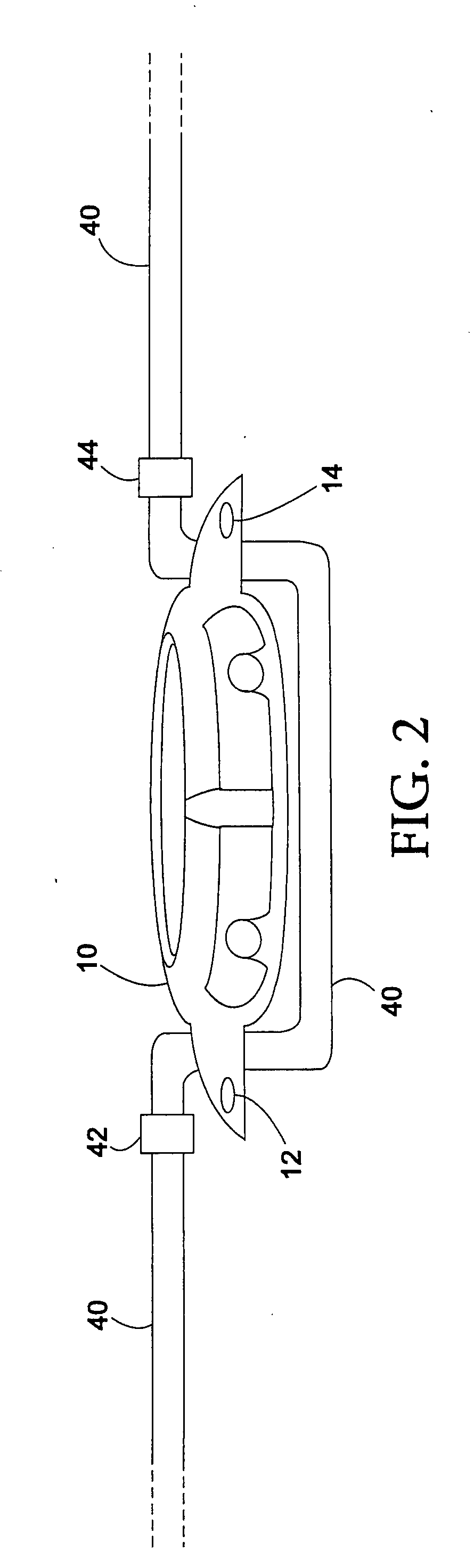 Quick-change watchbands