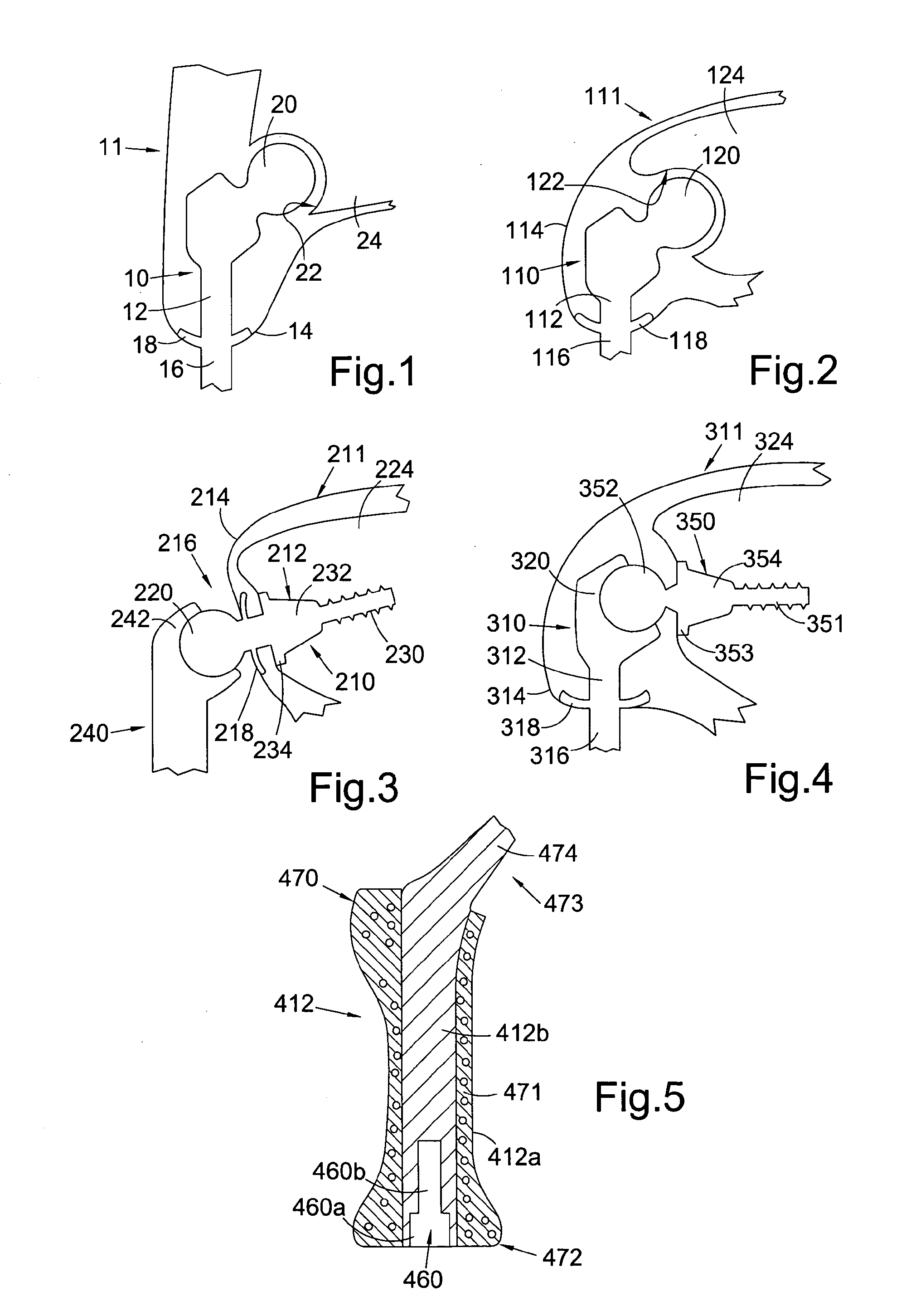 Intracorporeal Component for a Percutaneous Device