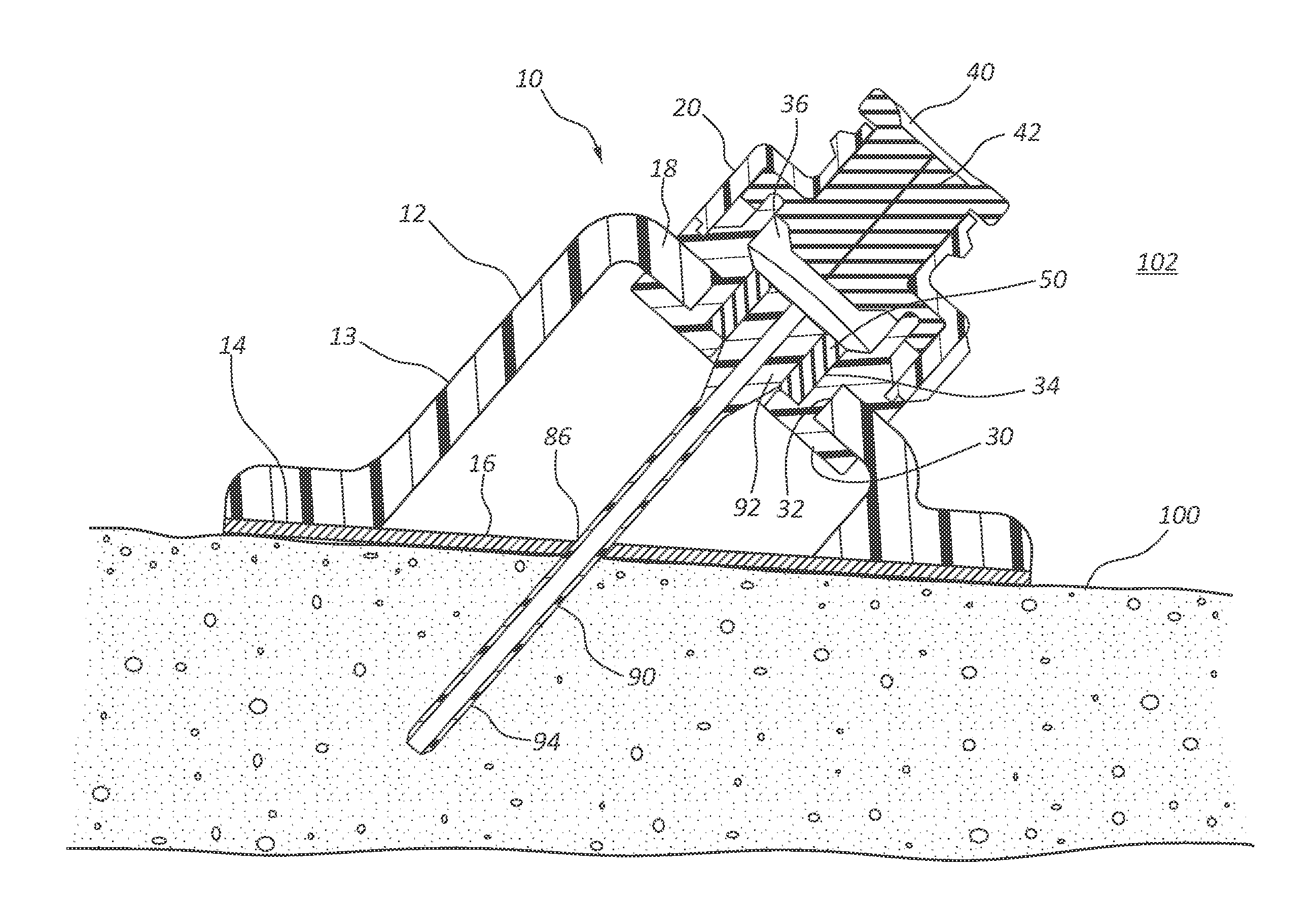 Luer securement device