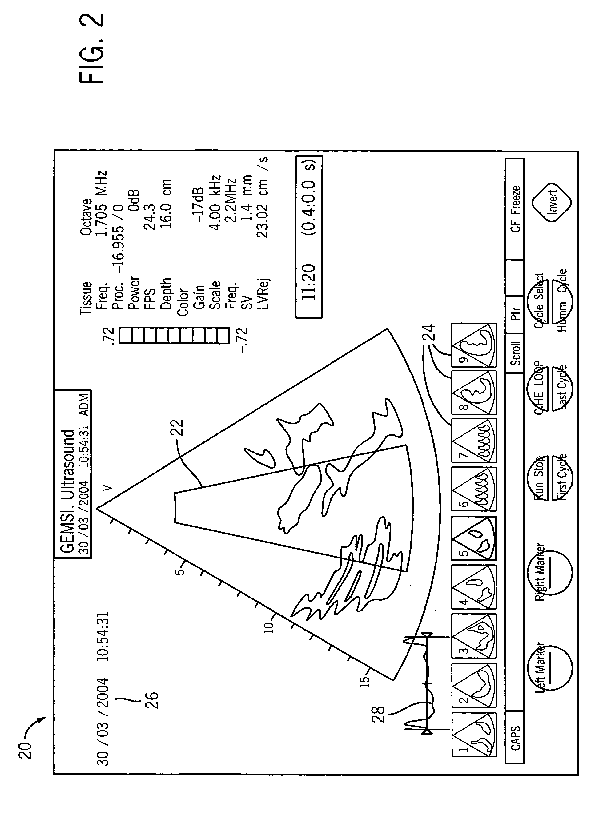 Integrated anesthesia monitoring and ultrasound display