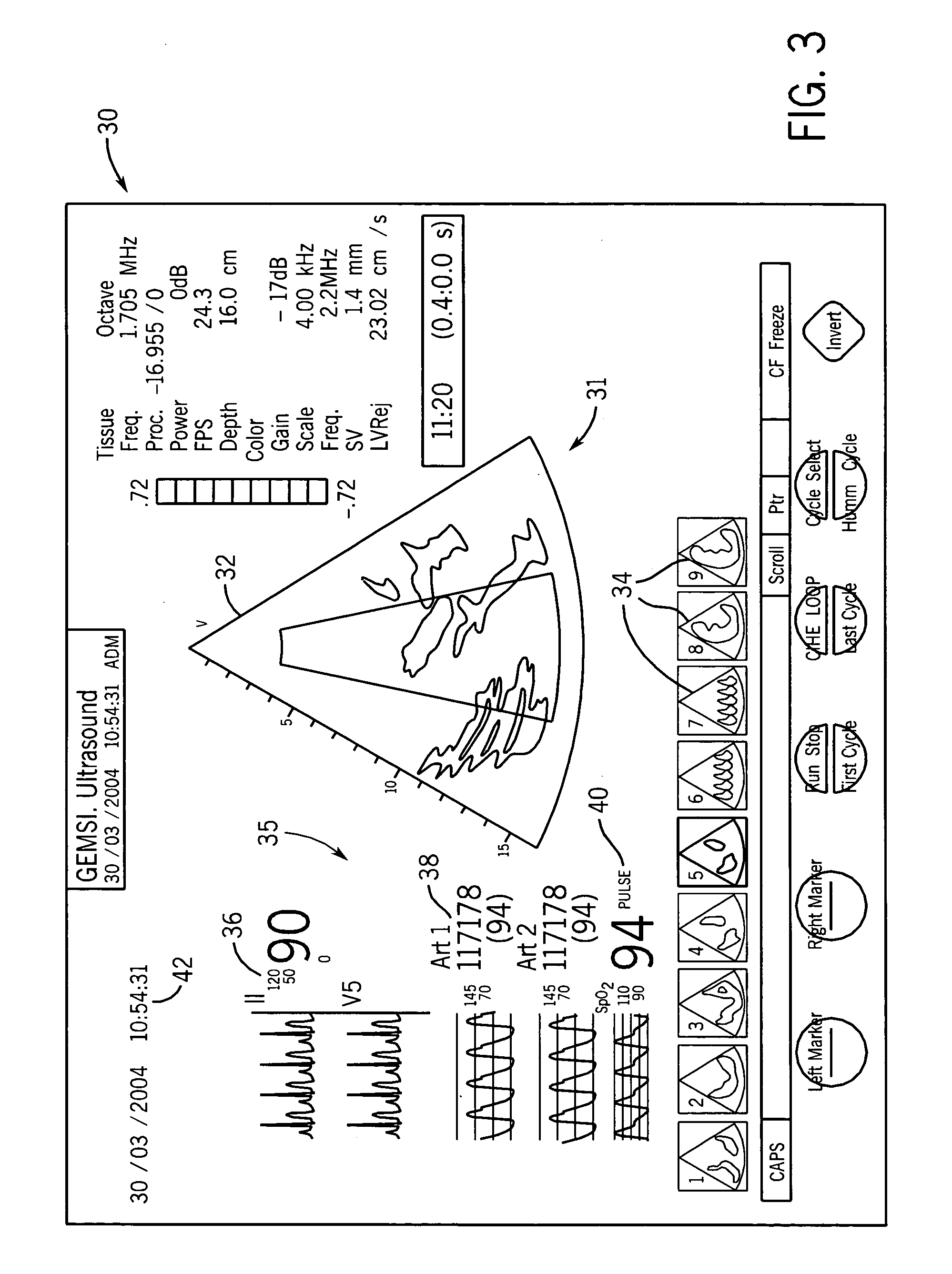 Integrated anesthesia monitoring and ultrasound display