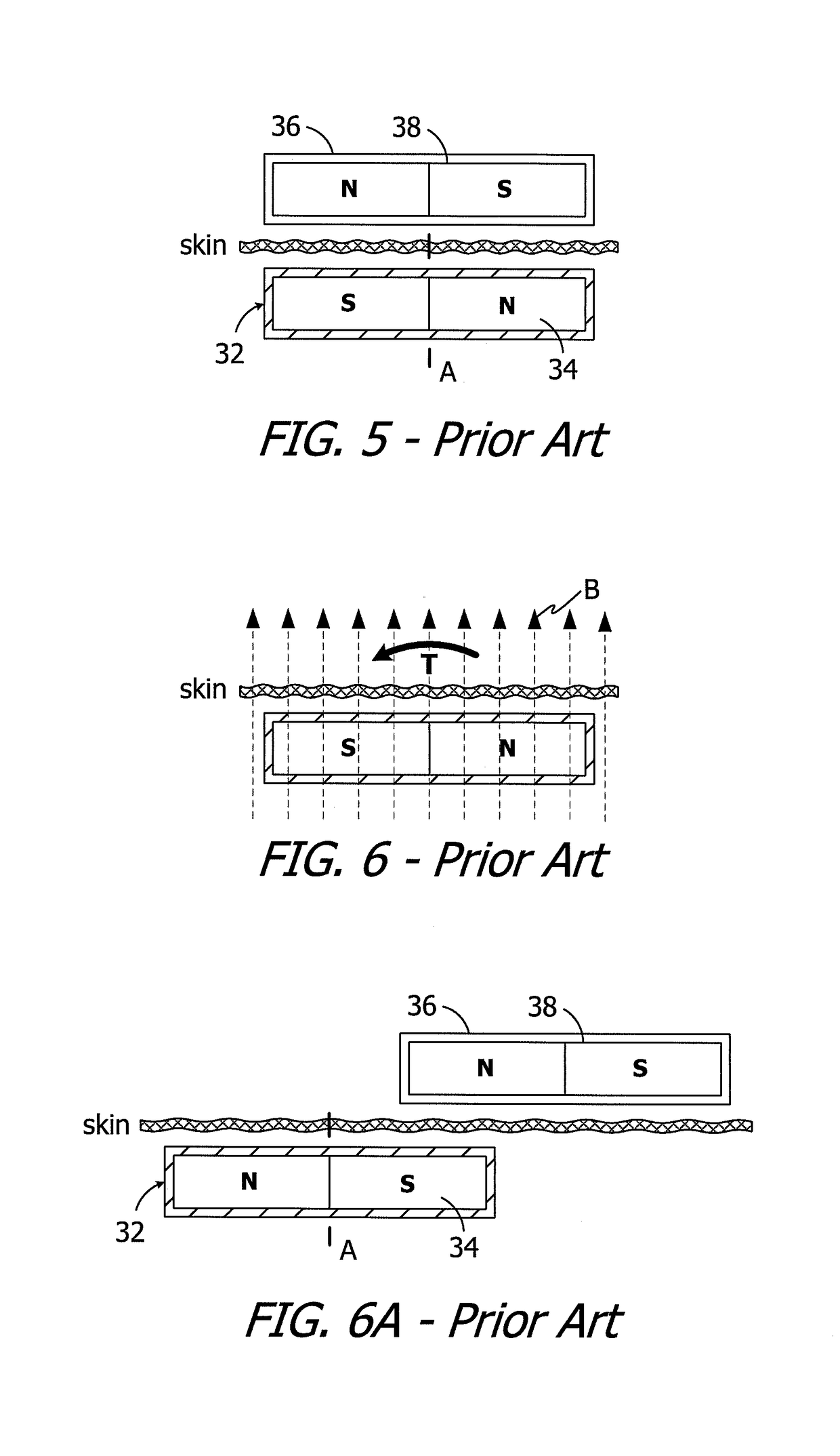 Cochlear implants having MRI-compatible magnet apparatus and associated methods