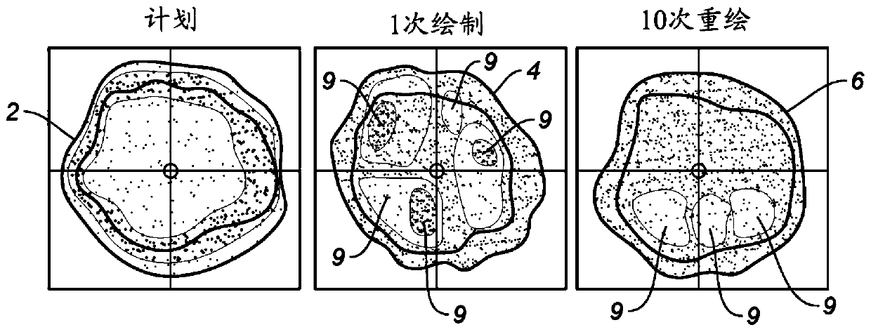 Mitigation of interplay effect in particle radiation therapy