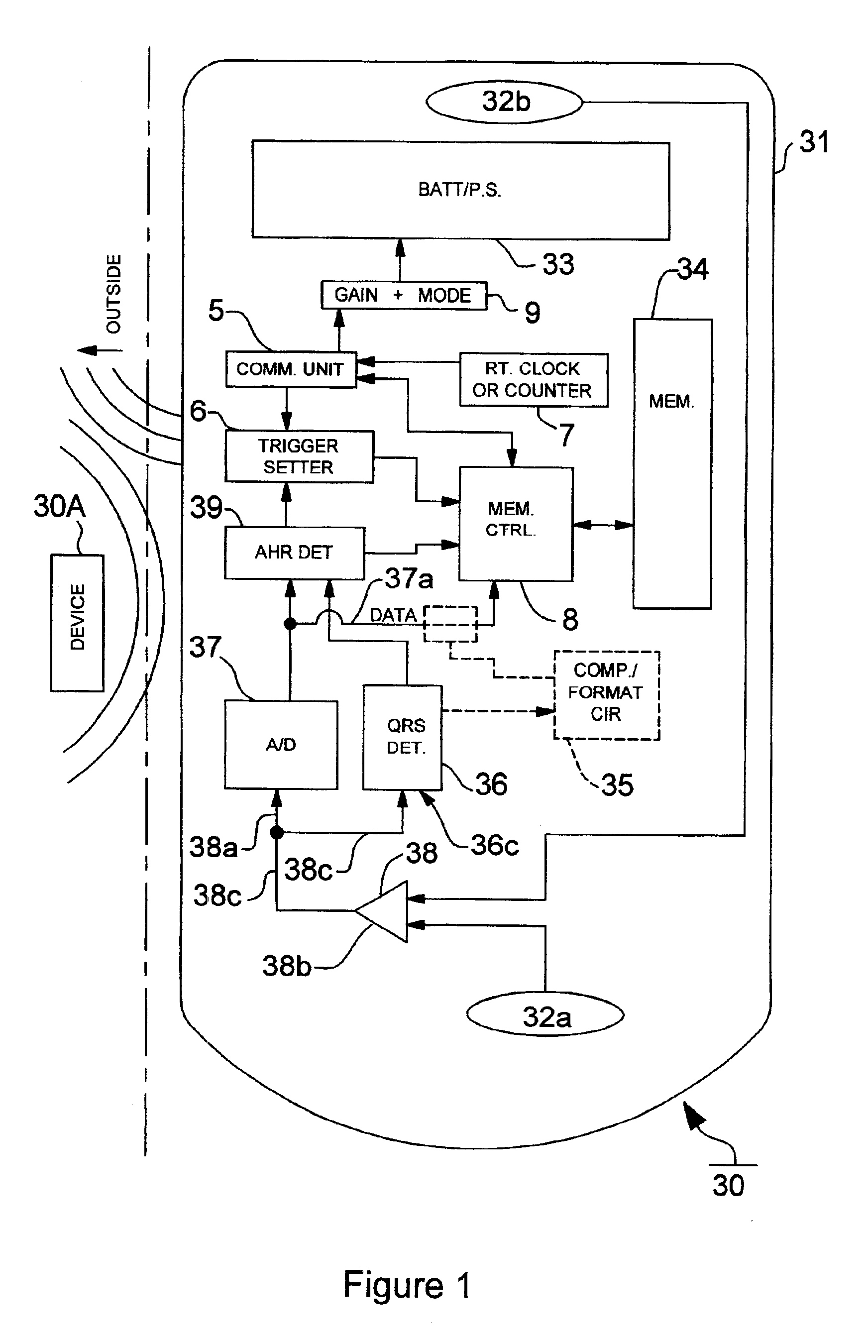 Method and apparatus for discrimination atrial fibrillation using ventricular rate detection