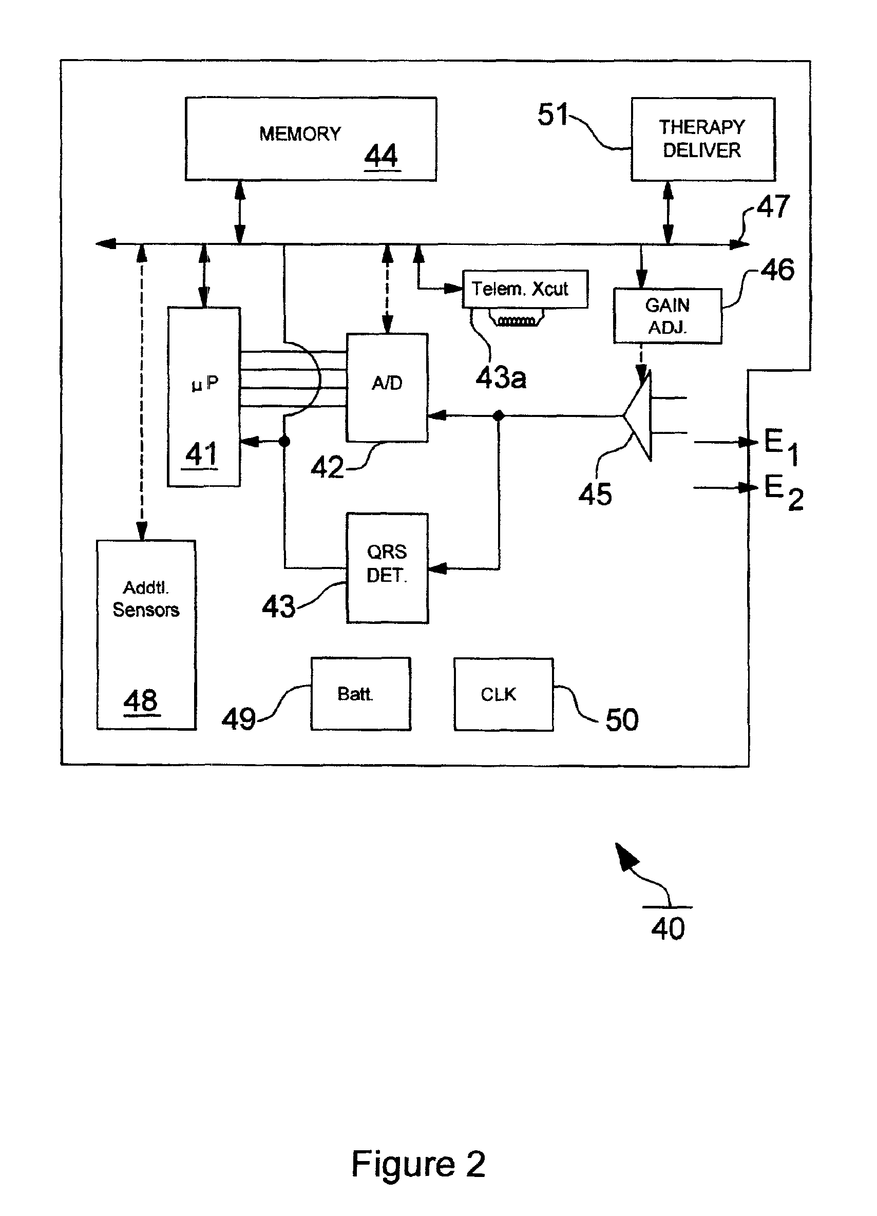 Method and apparatus for discrimination atrial fibrillation using ventricular rate detection