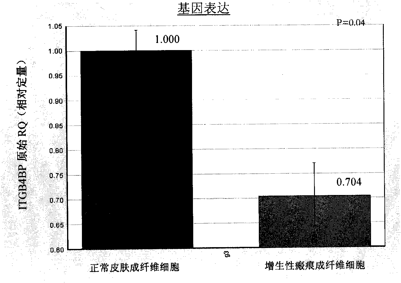 ITGB4BP and derivates thereof used for preventing and/or treating hypertrophic scar and fibrosis lesion