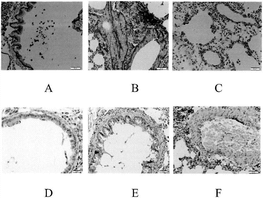 Pharmaceutical composition for treating asthma