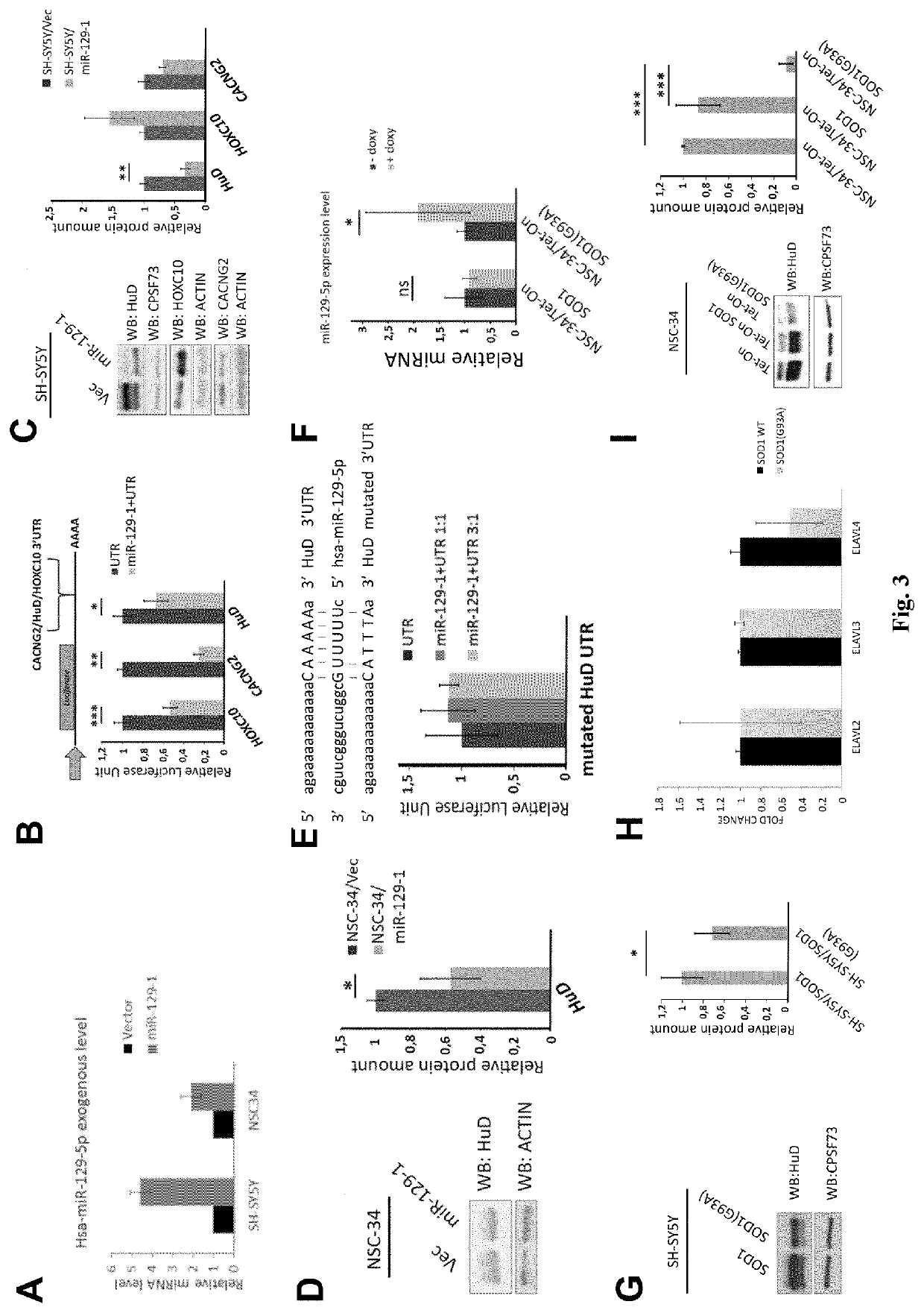 Inhibitor of mir-129 and uses thereof