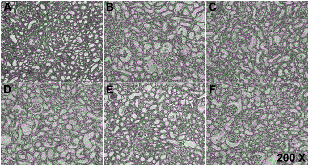 Application of desmodium styracifolium extract in urinary calculus