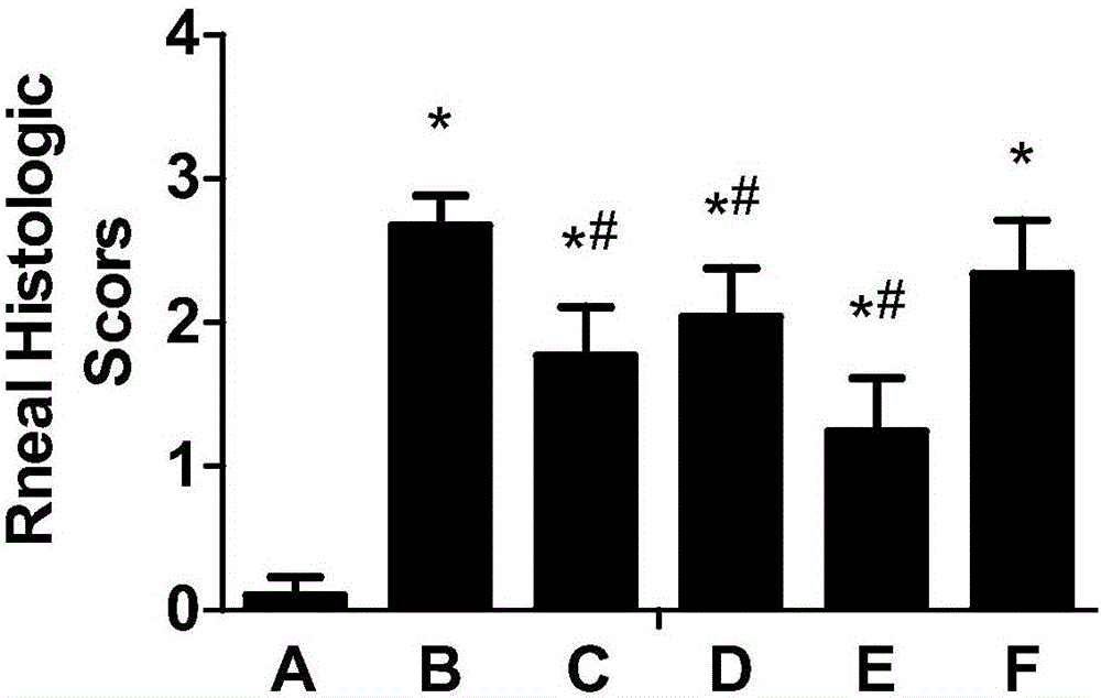 Application of desmodium styracifolium extract in urinary calculus