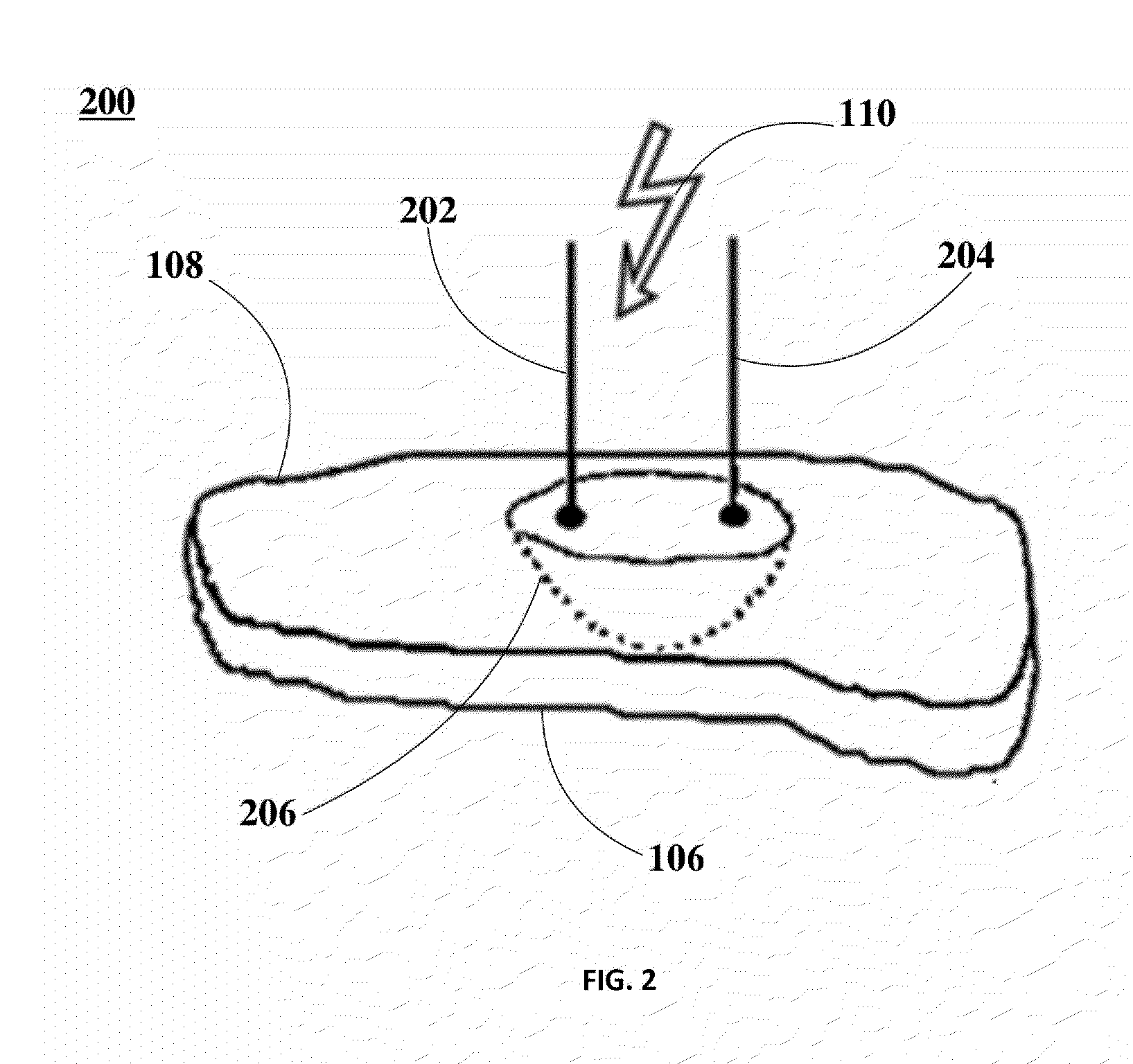 Ablation of Myocardial Tissues with Nanosecond Pulsed Electric Fields