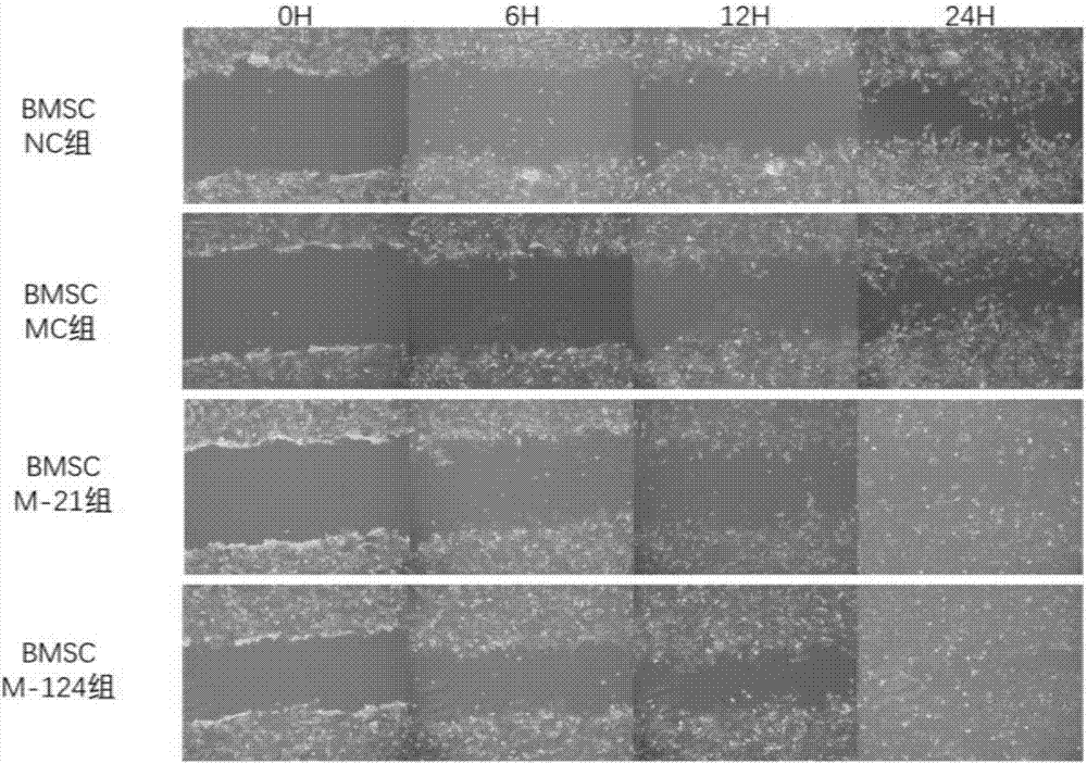 Recombinant mesenchymal stem cells and preparing method thereof