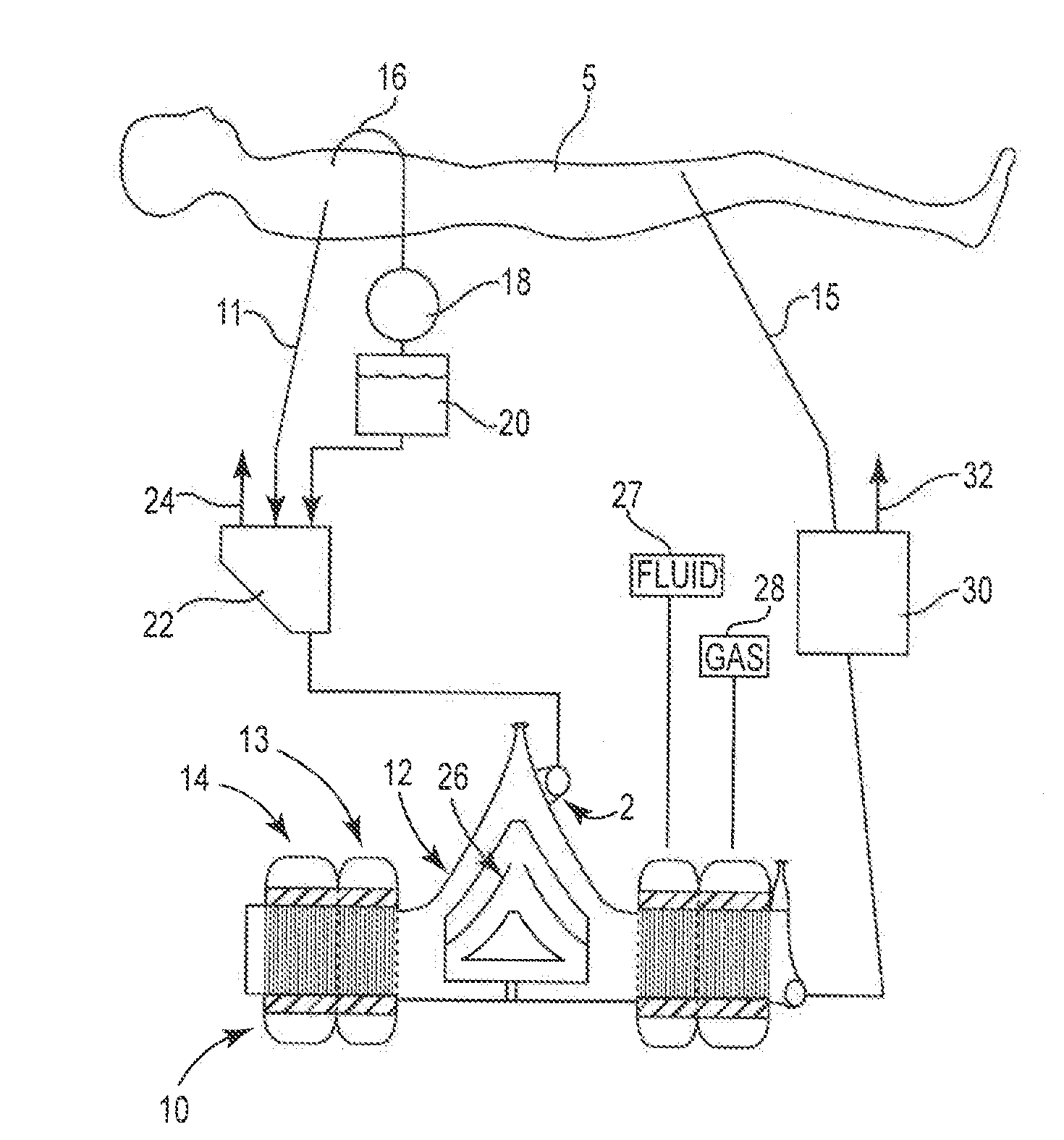 Radial Design Oxygenator with Heat Exchanger and Integrated Pump