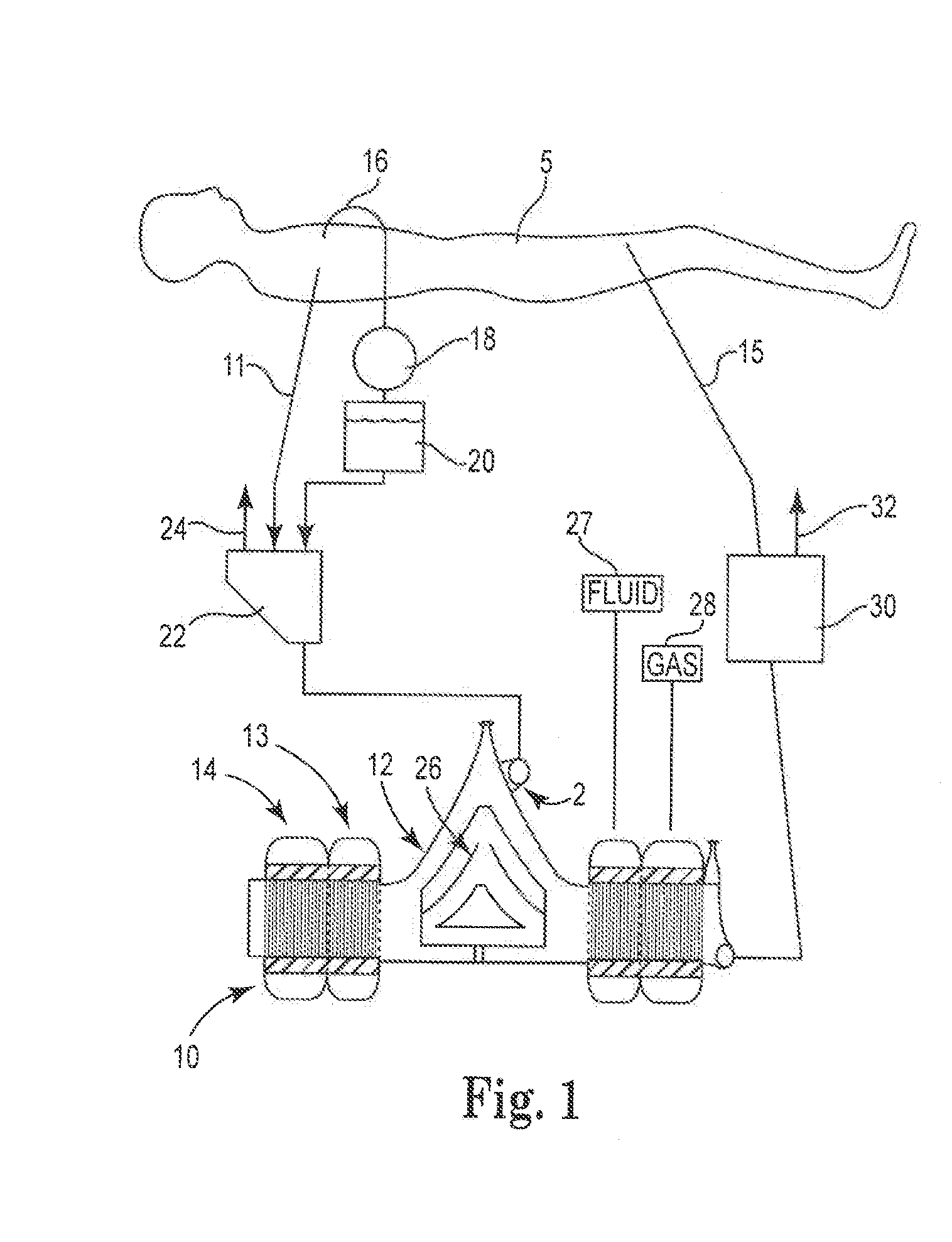 Radial Design Oxygenator with Heat Exchanger and Integrated Pump