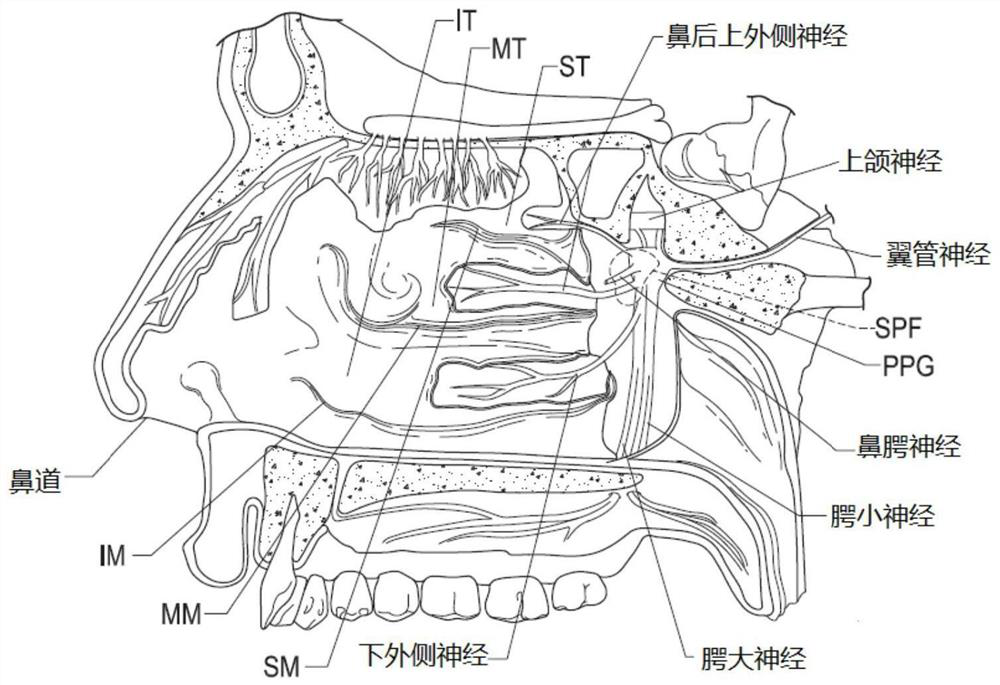 Devices and related methods and systems for therapeutic nasal neuromodulation