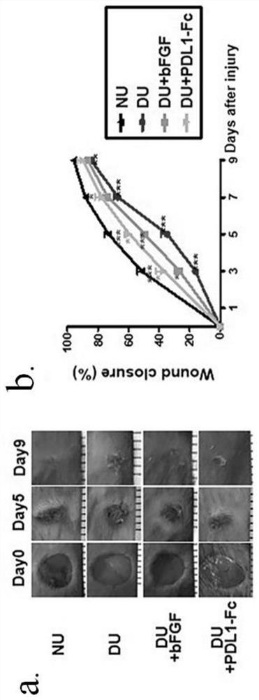 Application of eIF3I-PDL1-IRS4 axis in preparation of medicine for treating refractory ulcer