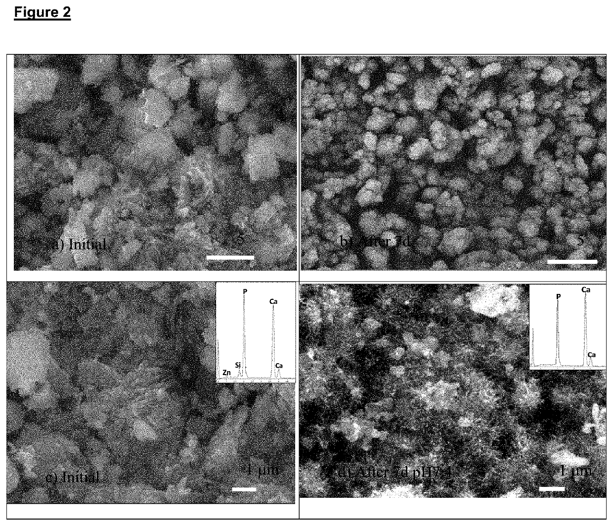 Composition of materials for tooth remineralisation