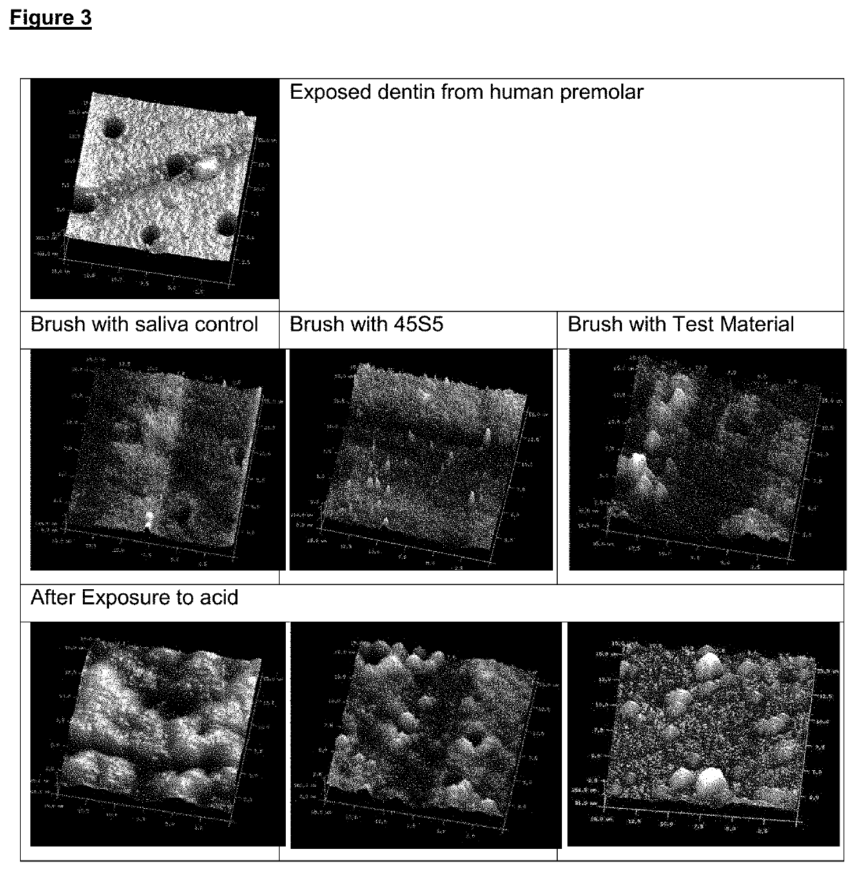 Composition of materials for tooth remineralisation