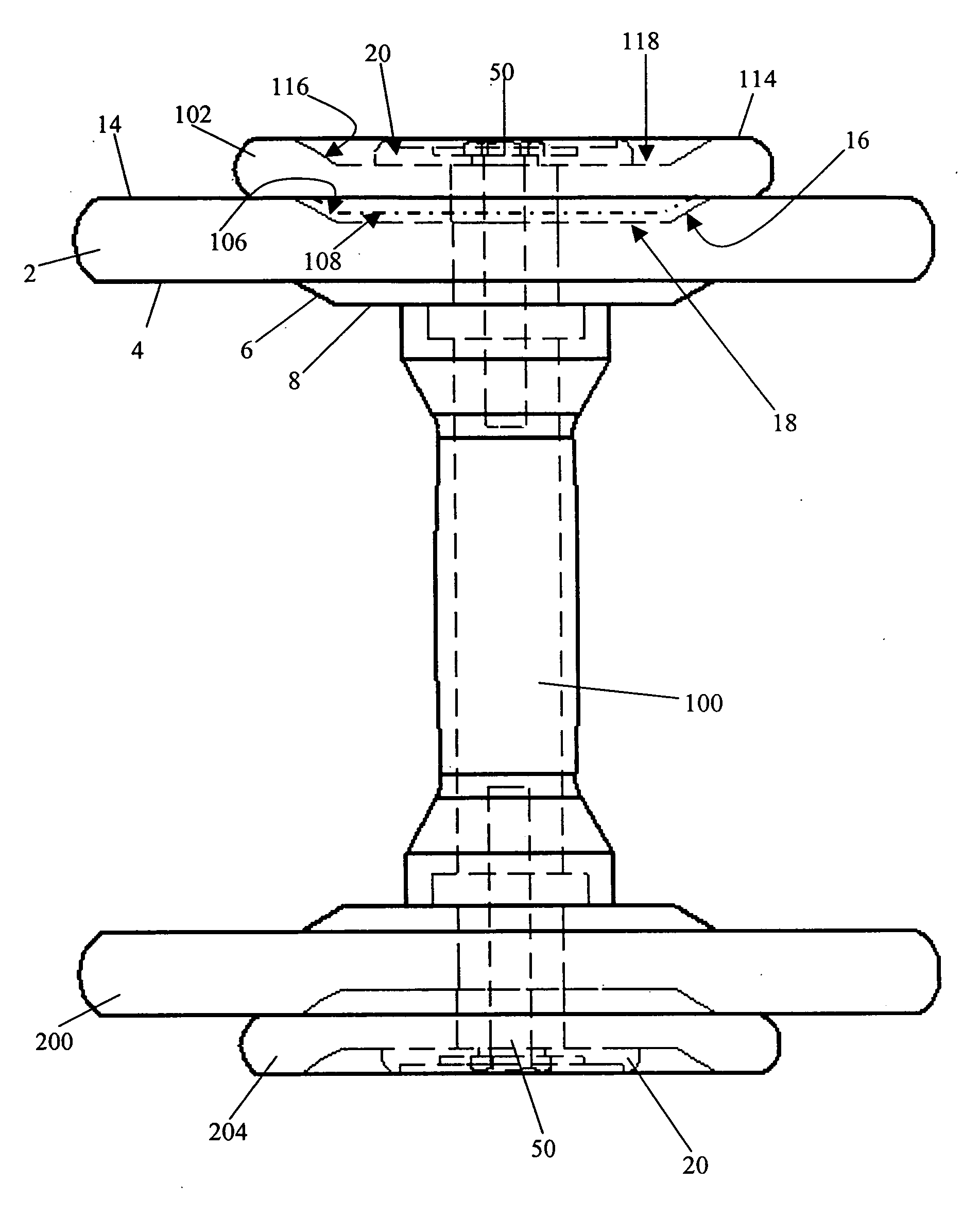 Stackable weight system