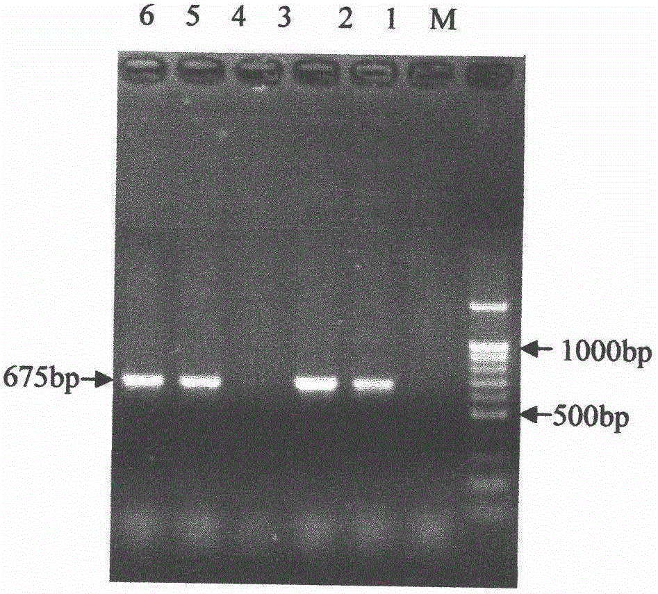 Plum necrotic ringspot virus coat protein gene expression method, antiserum and kit