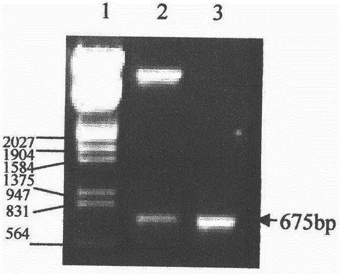 Plum necrotic ringspot virus coat protein gene expression method, antiserum and kit