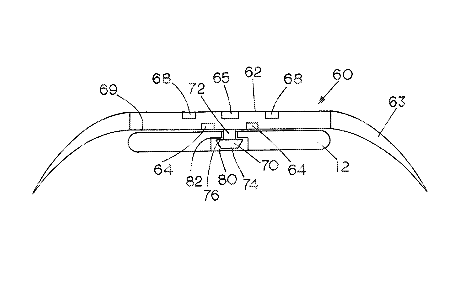 Moldable cushion for implants