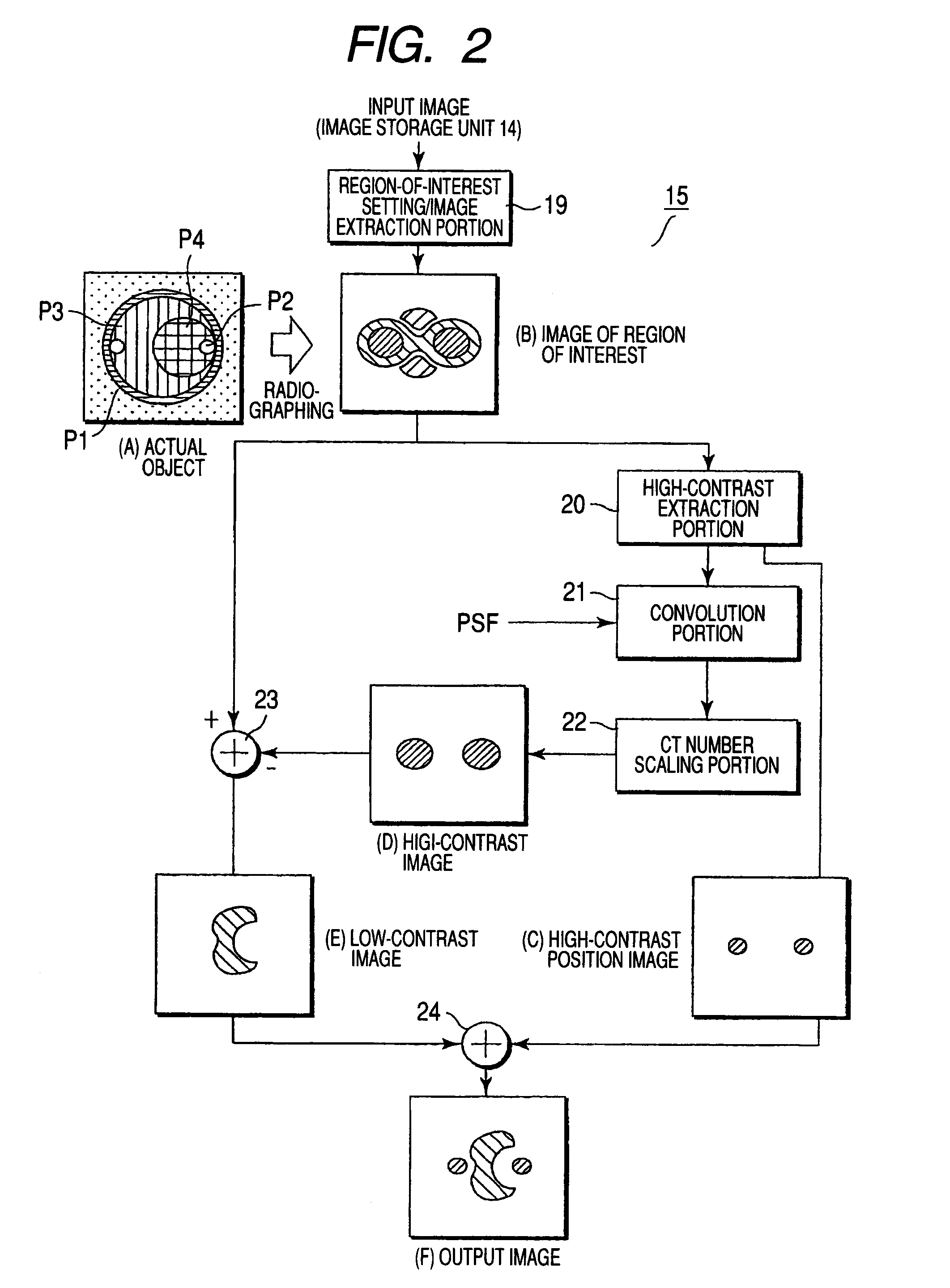 X-ray CT apparatus and image processing apparatus