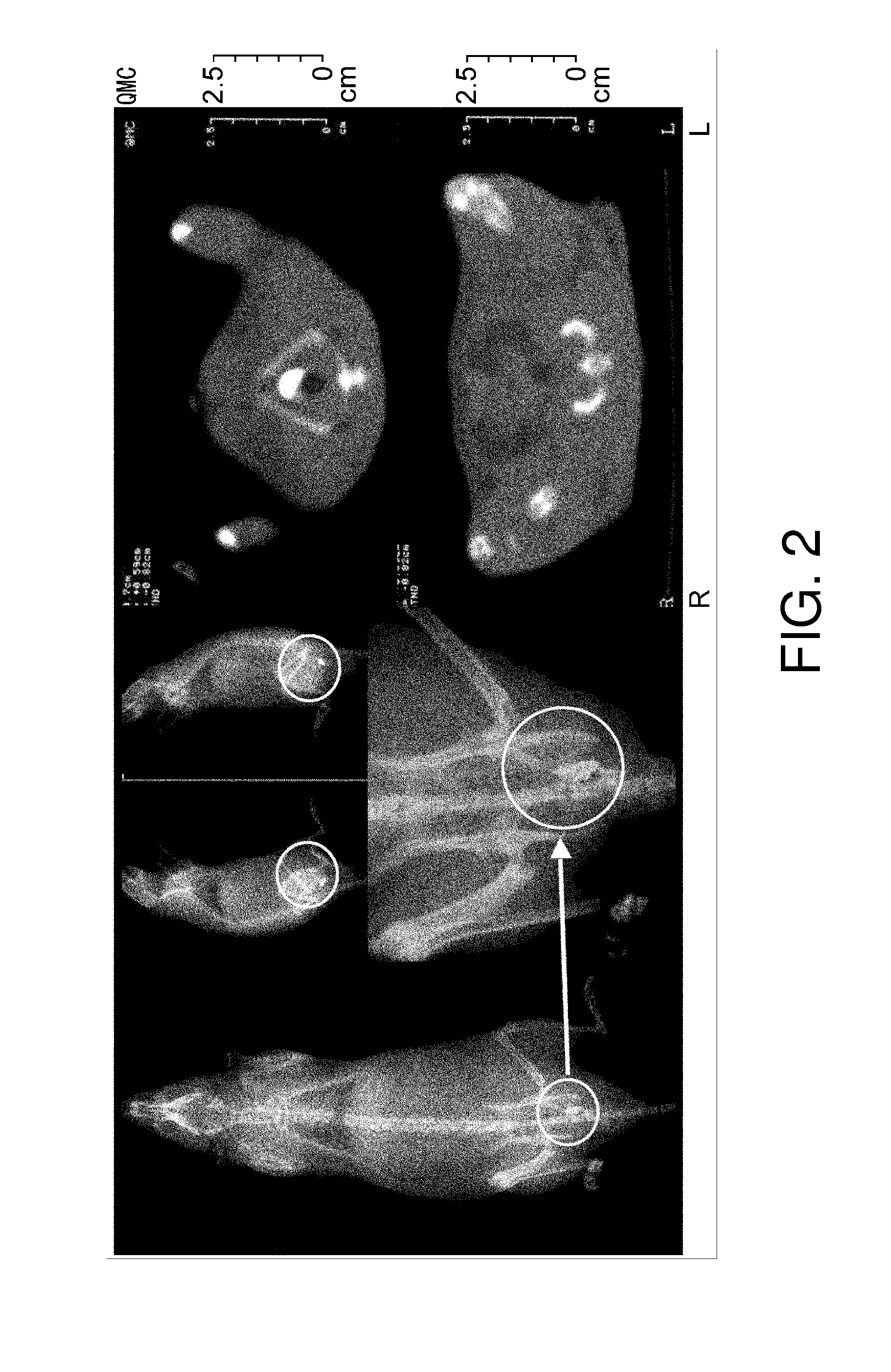 Method of fixing and expressing physiologically active substance