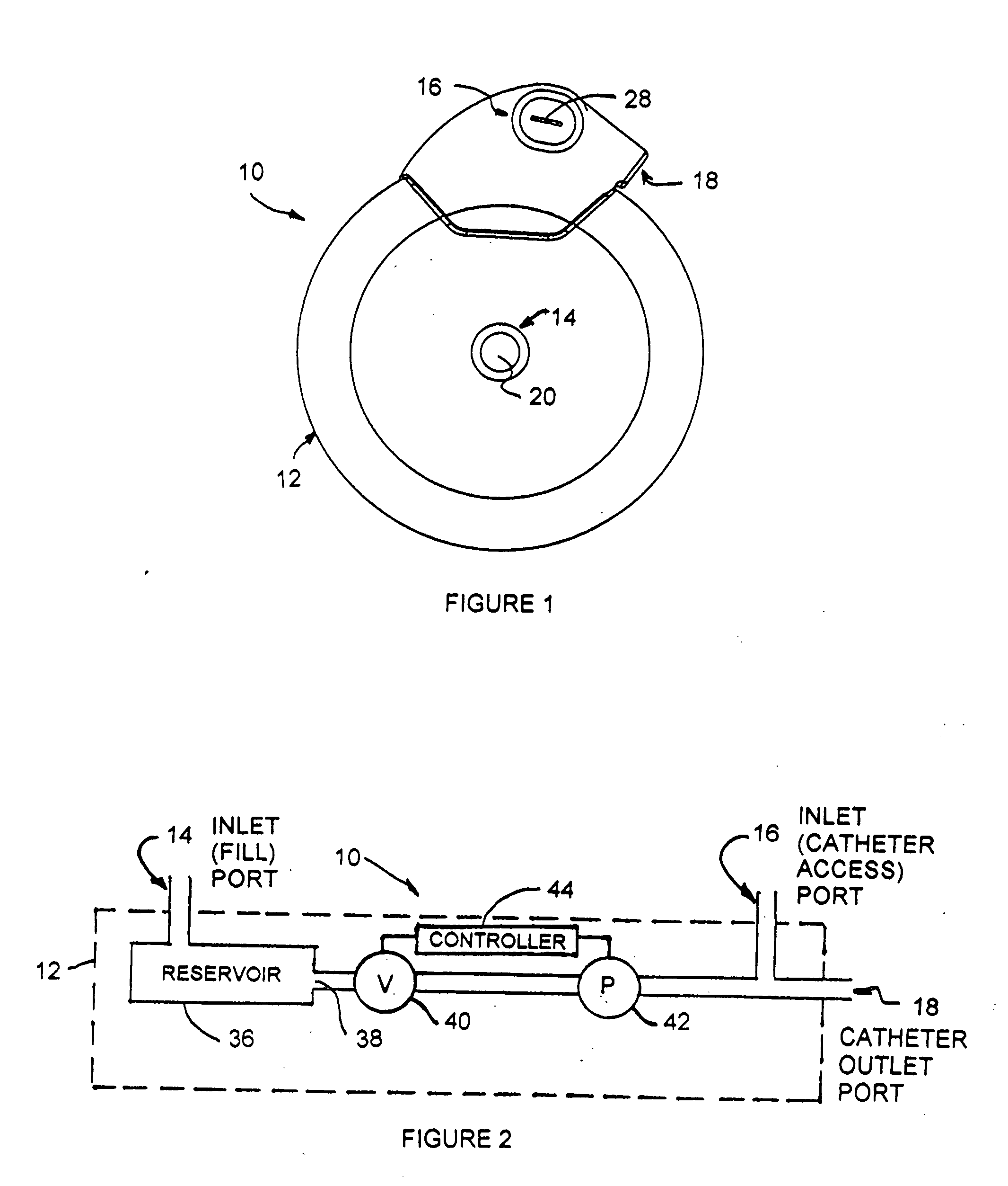 Implantable medication delivery device having needle receiving slot