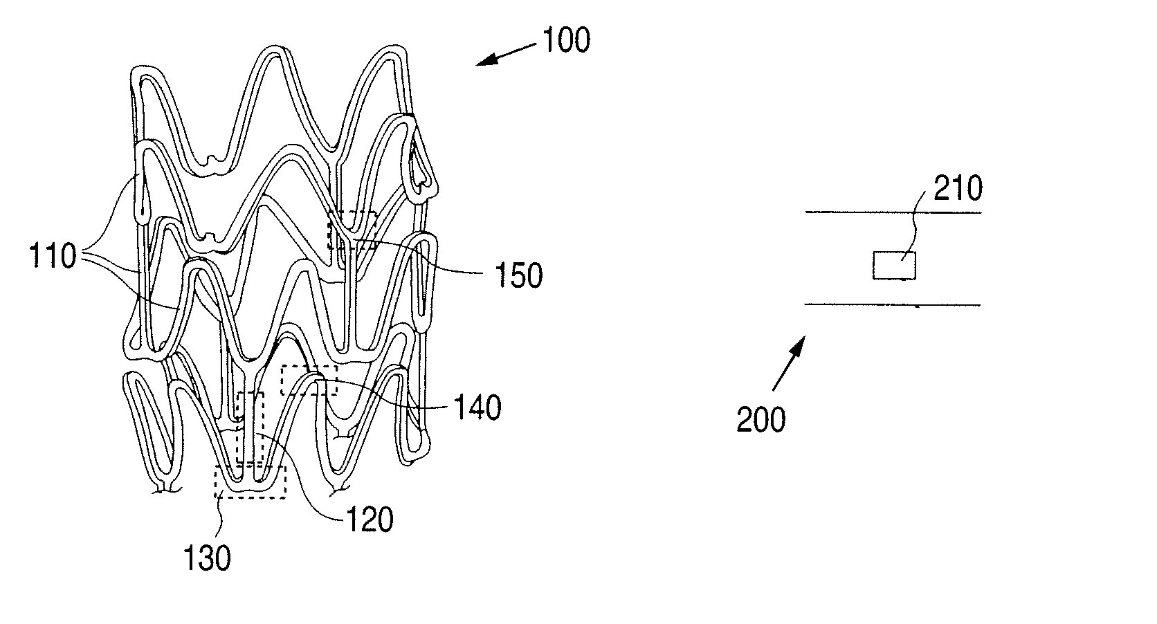 Stent formed from bioerodible metal-bioceramic composite